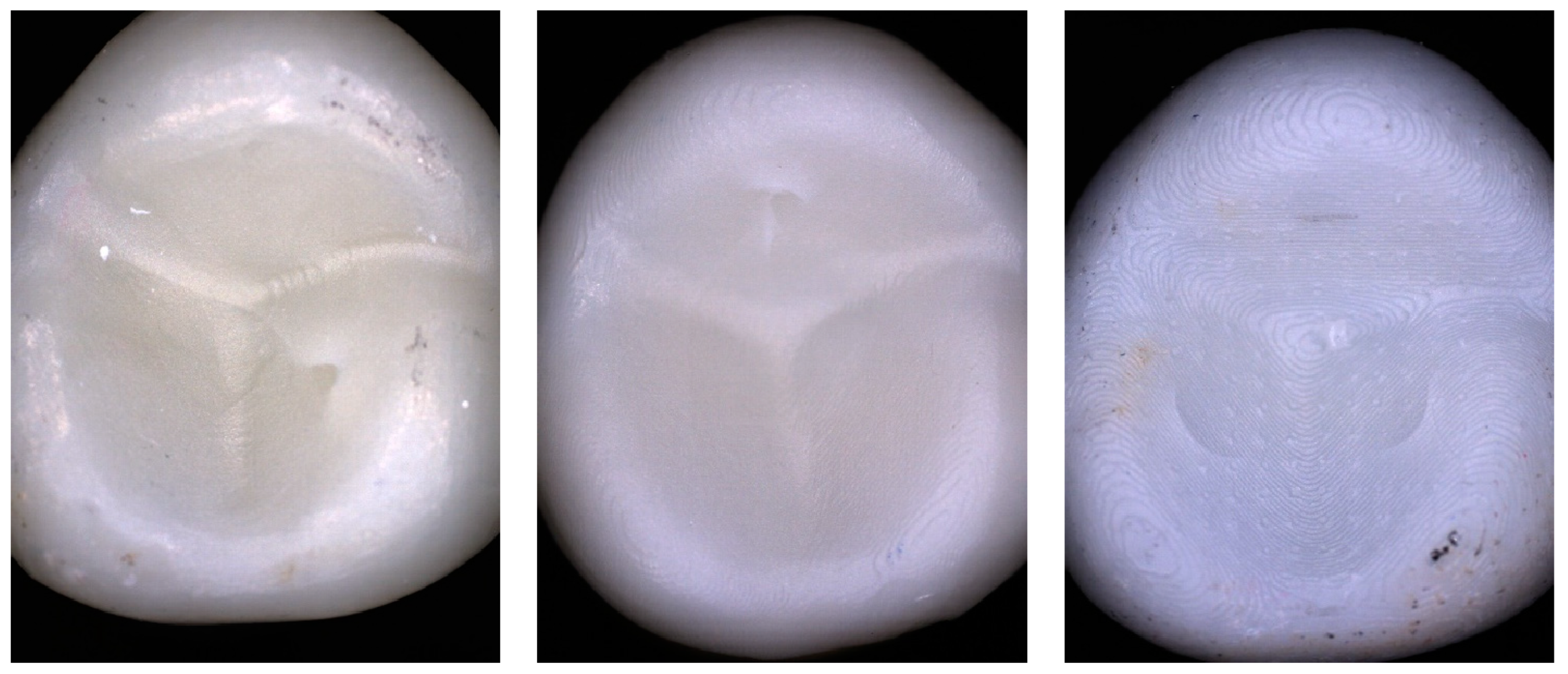 Materials 17 02122 g006