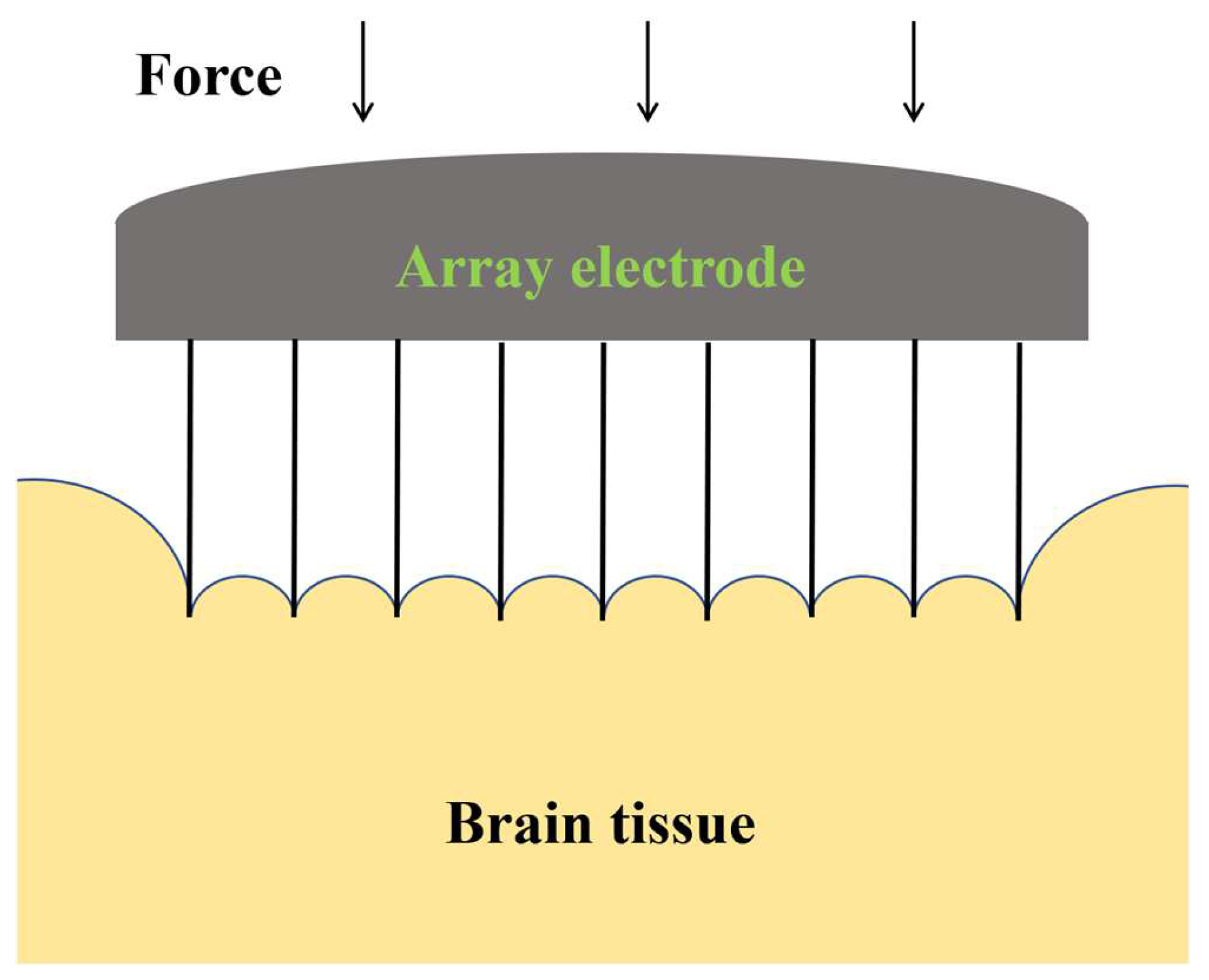 Materials 17 02334 g011