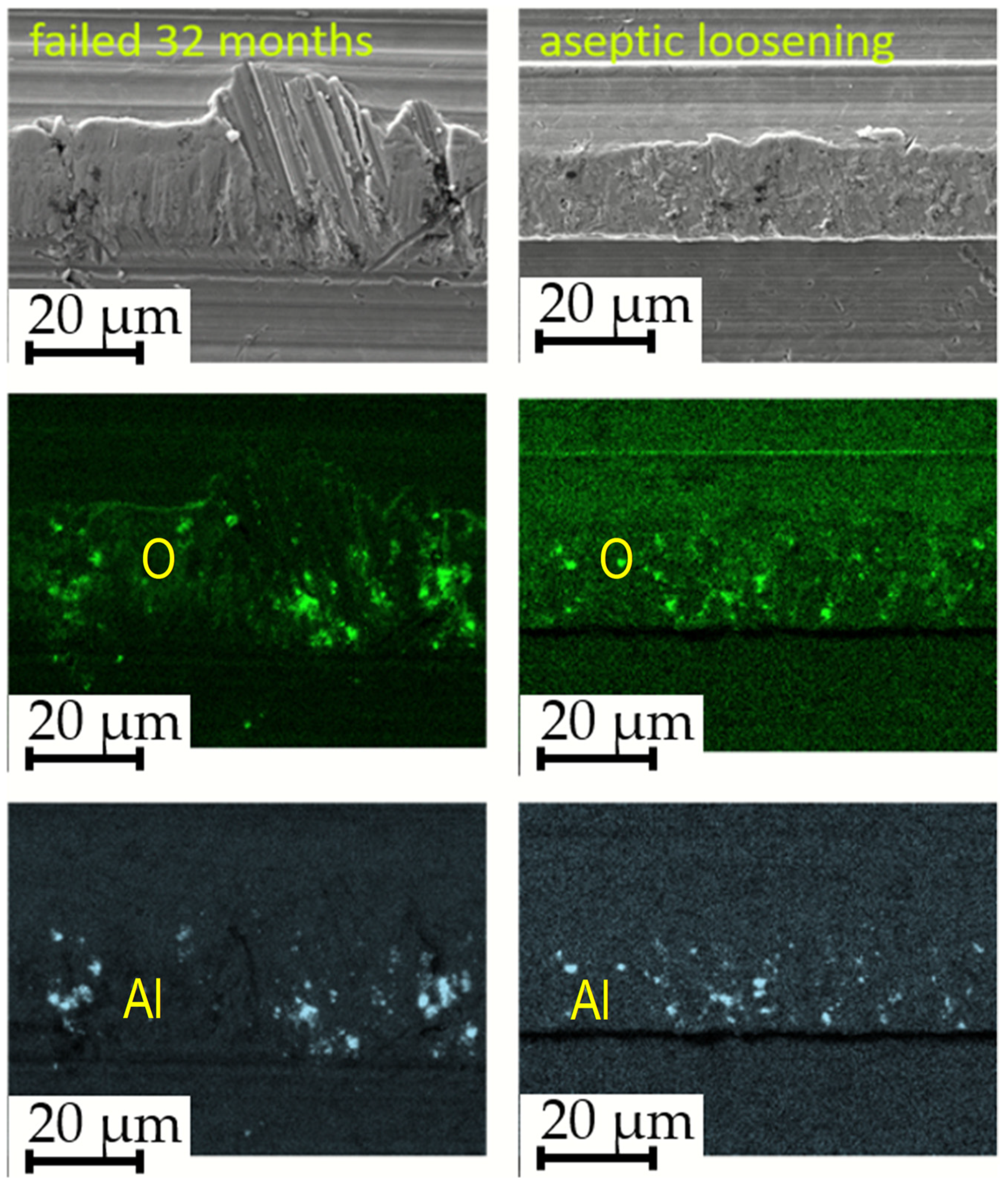 Materials 17 02751 g011