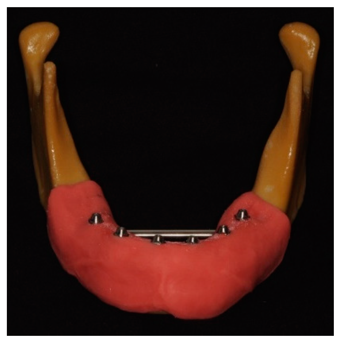 Materials 17 02932 g001