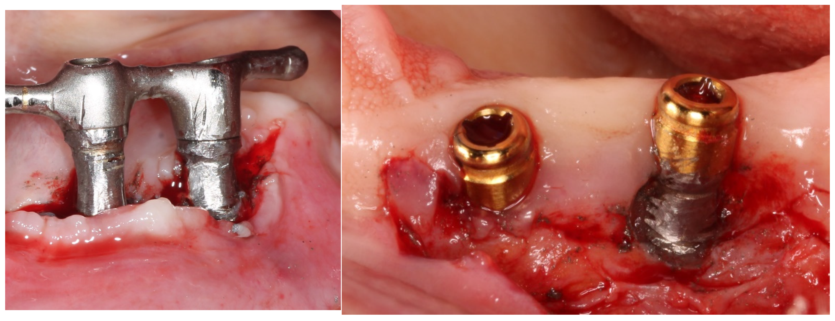 Materials 17 02944 g001