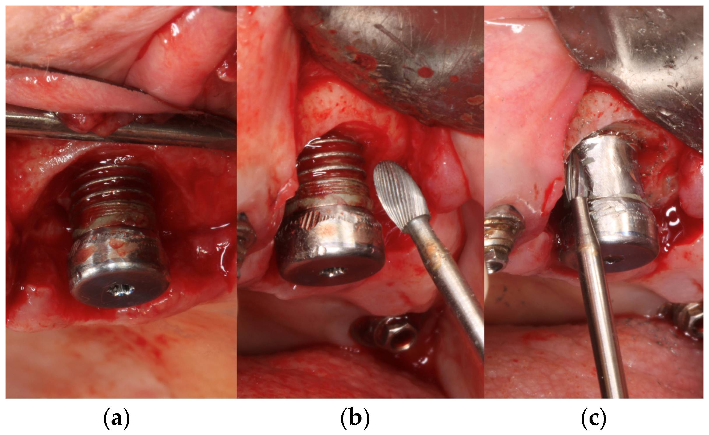 Materials 17 02944 g002a