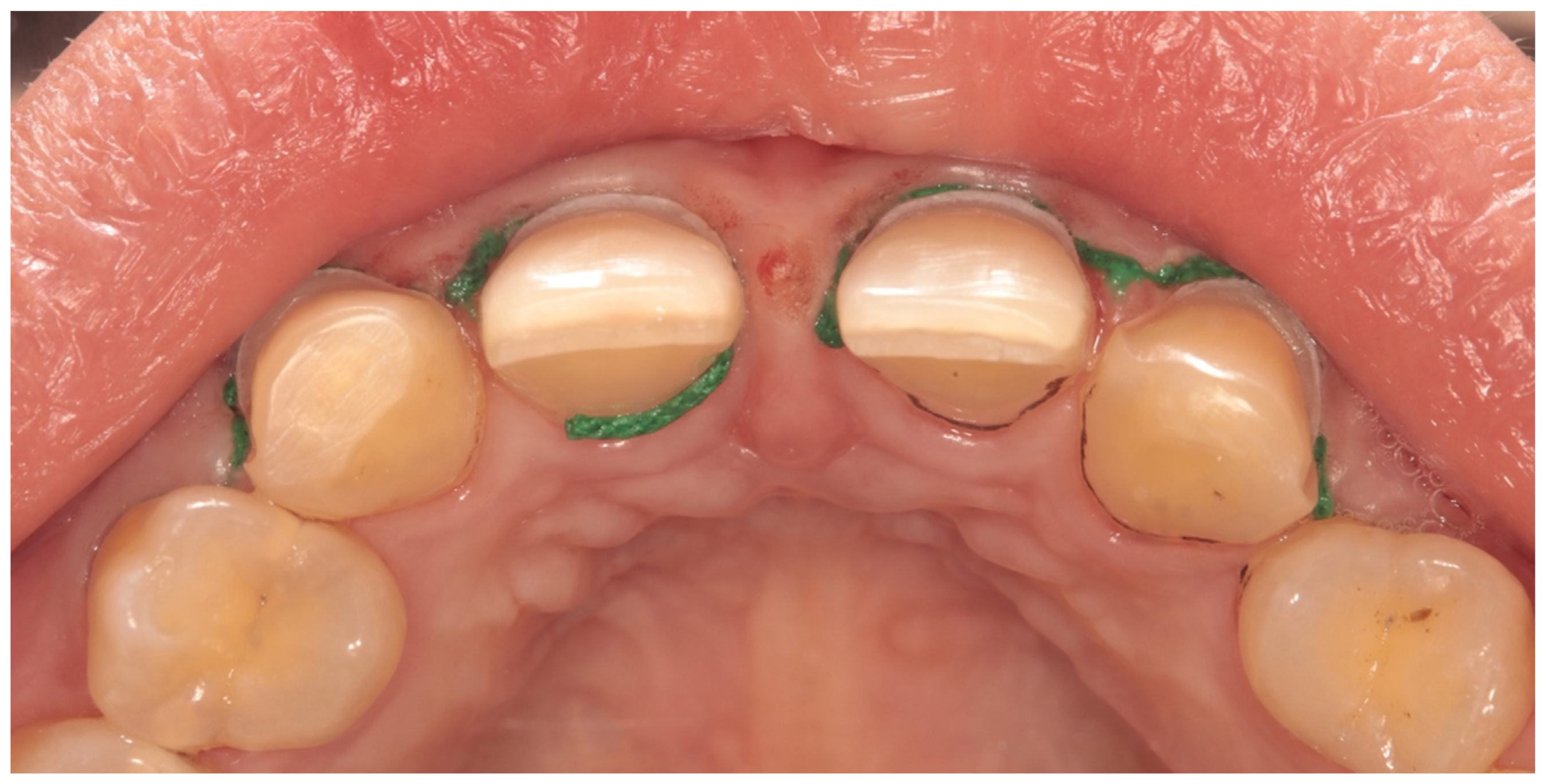 Materials 17 03514 g002