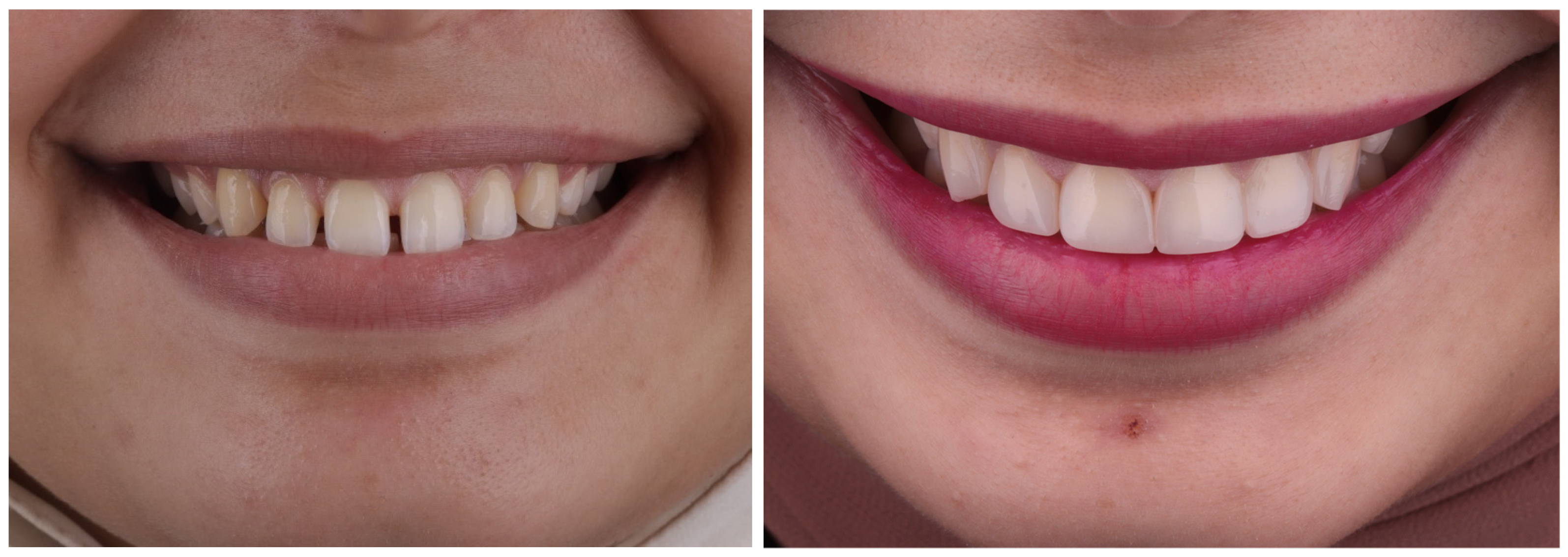 Materials 17 03514 g004