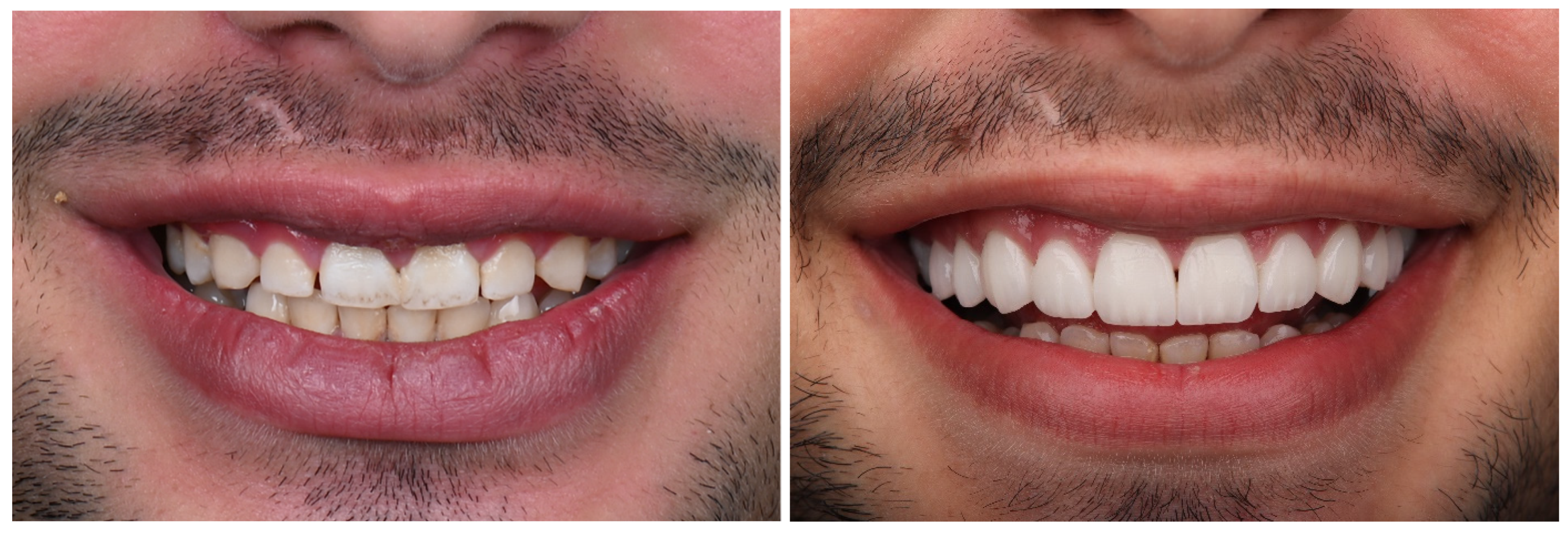 Materials 17 03514 g005