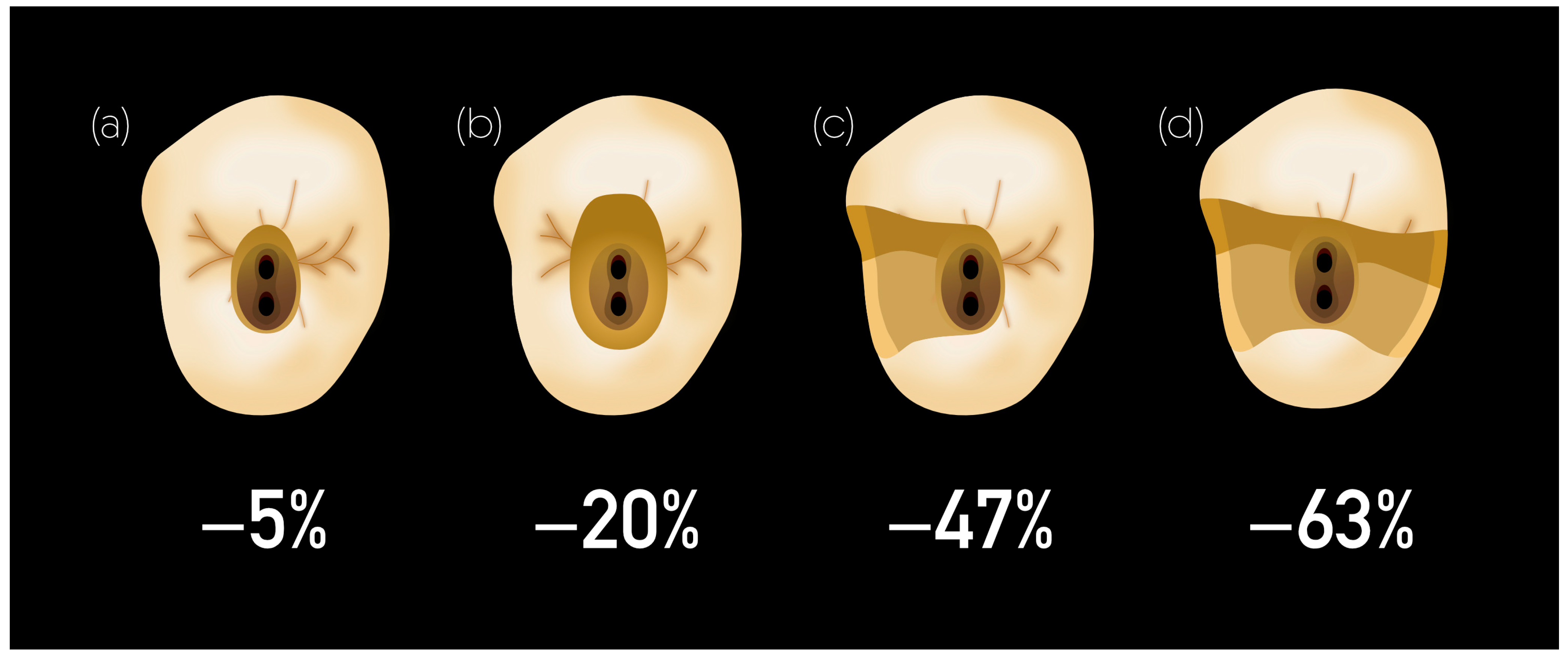 【裁断済み】How to Endodontics The State of th Advanced Material Strategy for Restoring Damaged