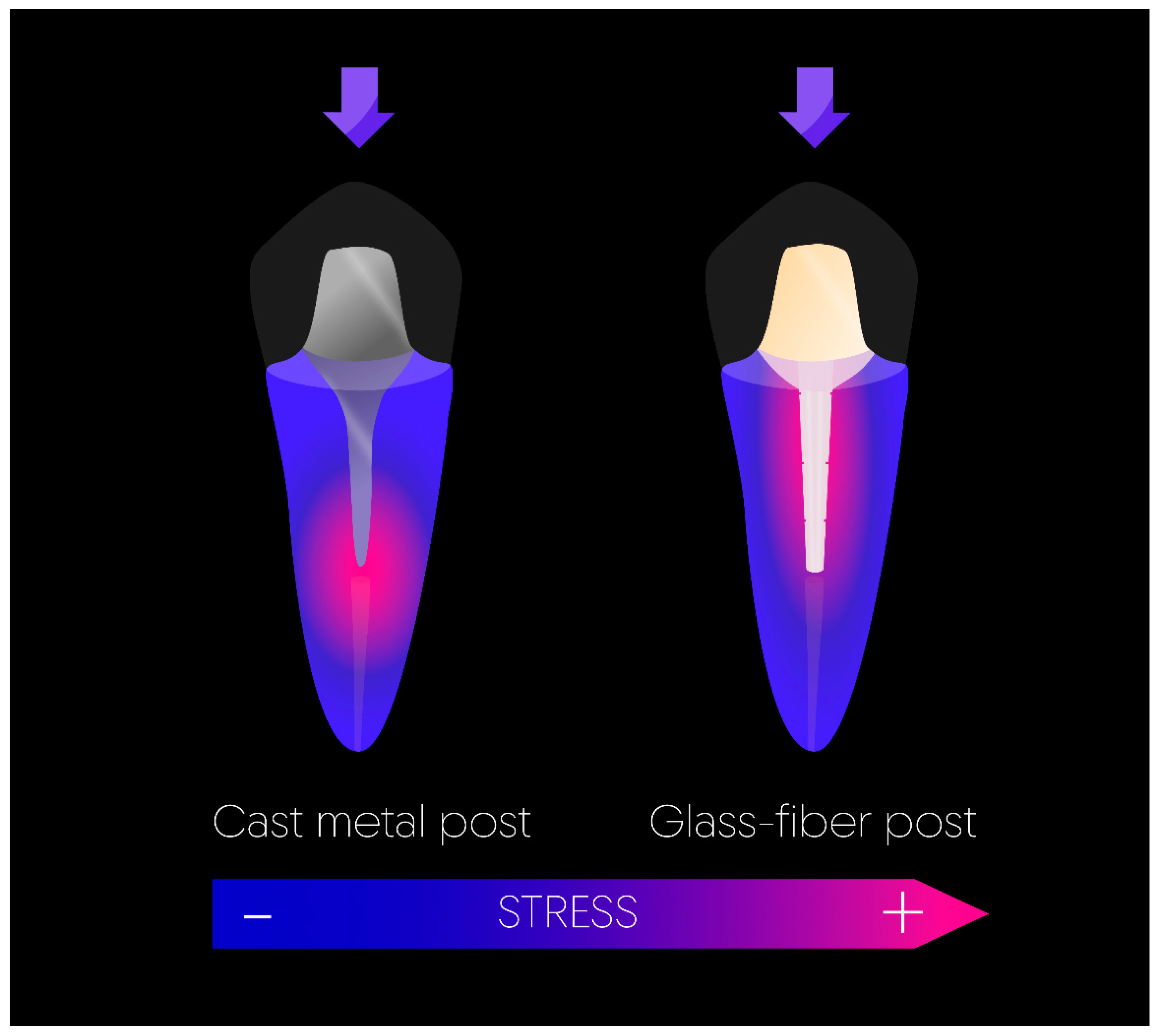 Advanced Material Strategy for Restoring Damaged