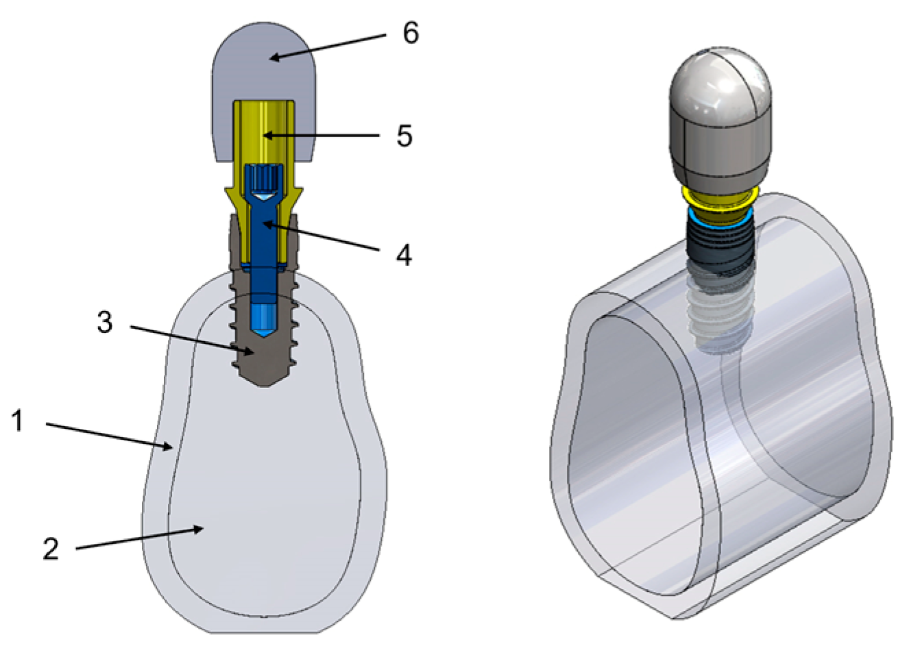 Materials 17 03746 g002
