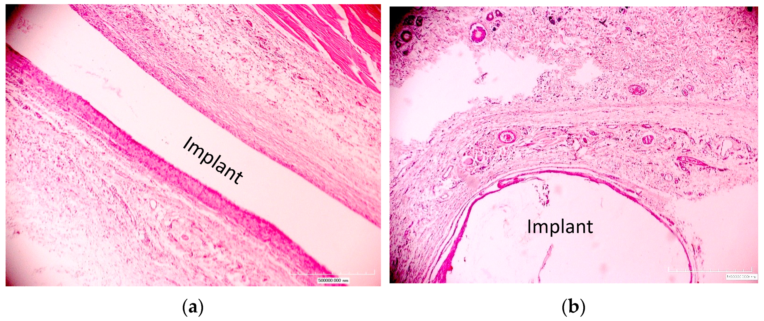 Materials 17 03833 g005