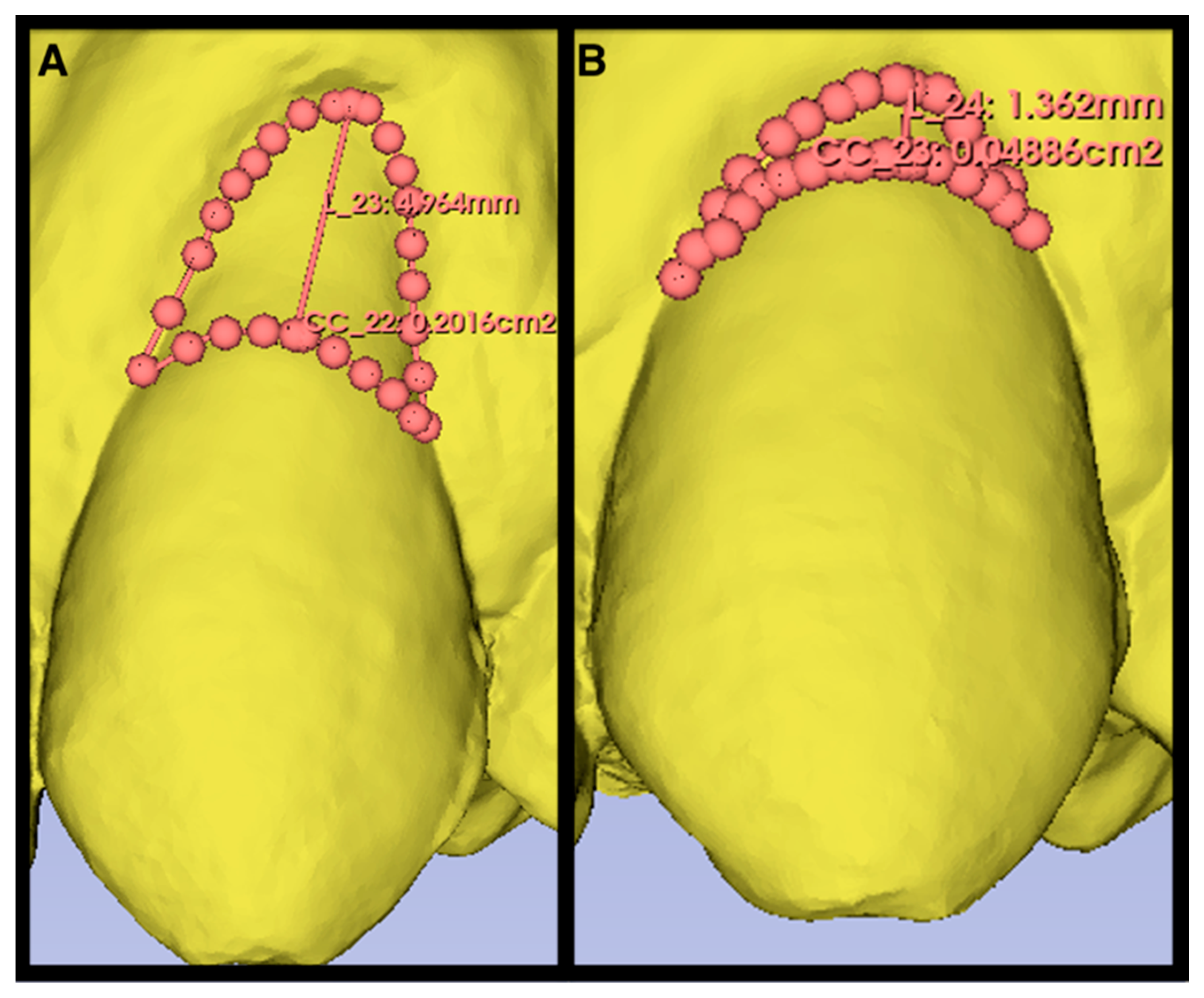 Materials 17 03985 g003
