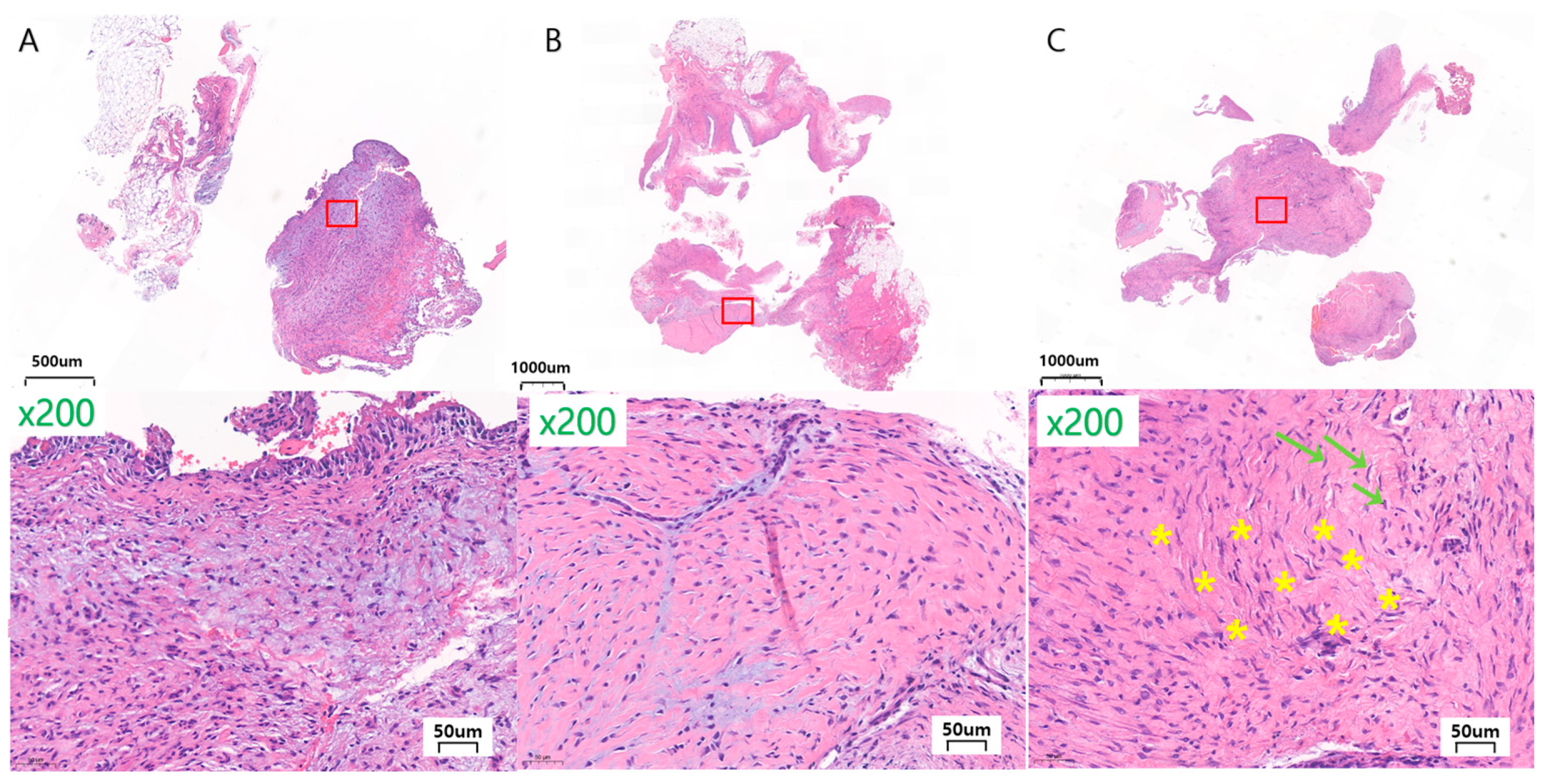 Materials 17 04435 g007