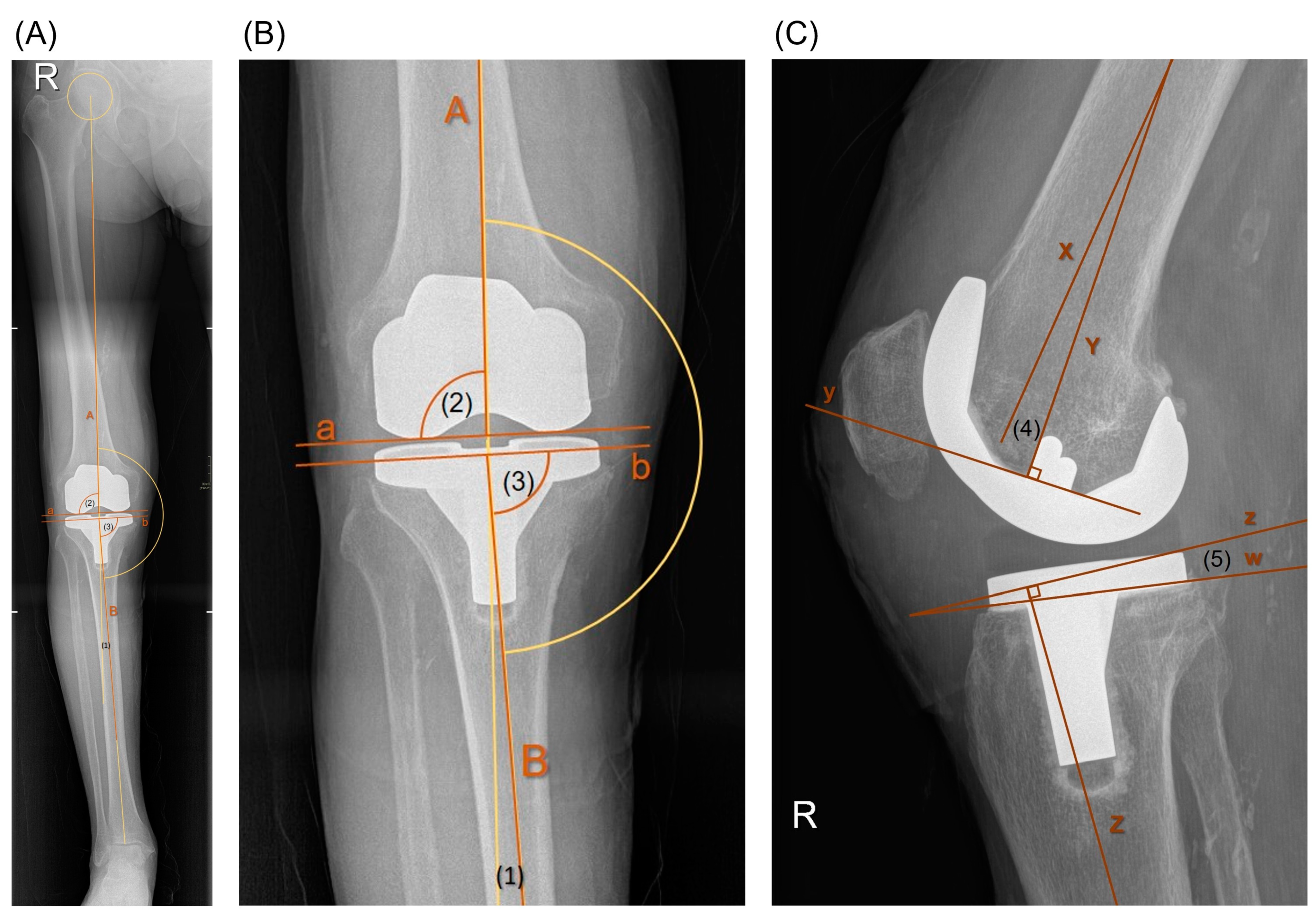 Materials 17 05007 g004