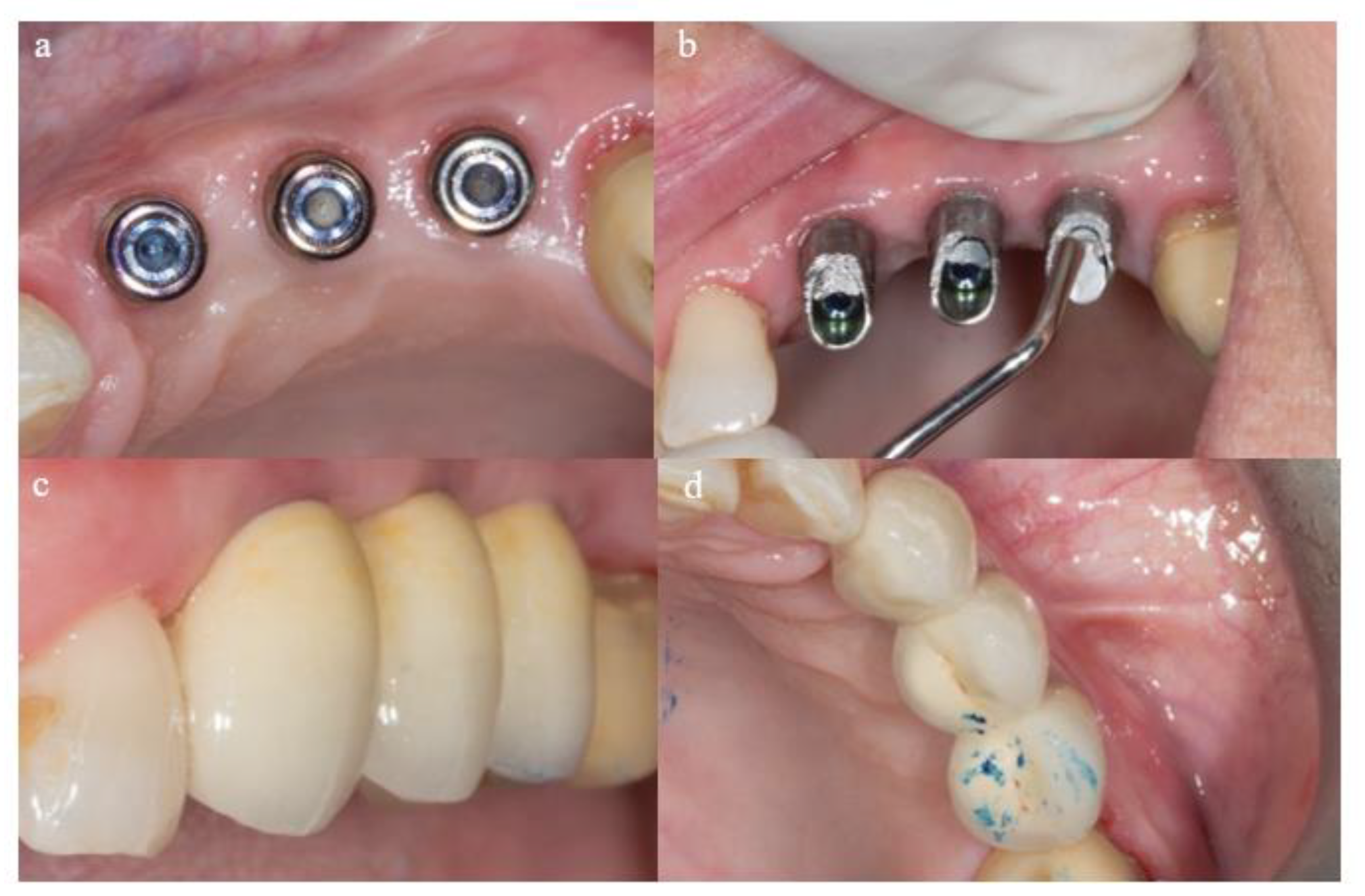 Materials 18 00183 g003