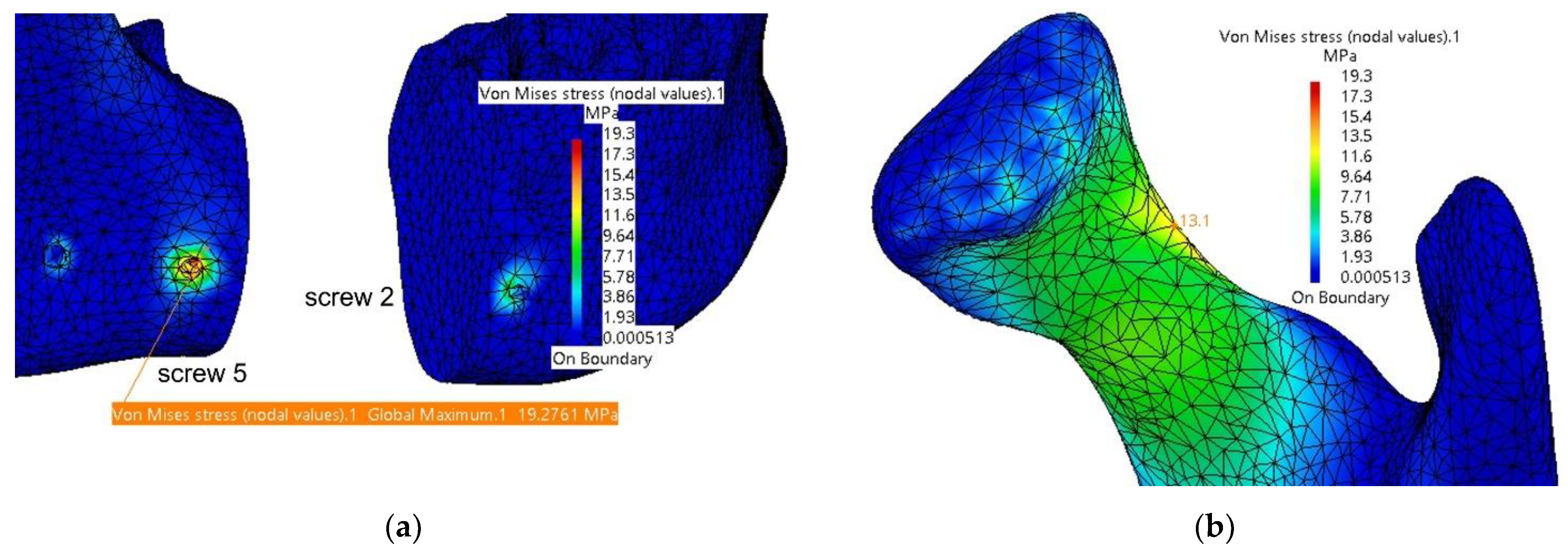 Materials 18 00314 g014