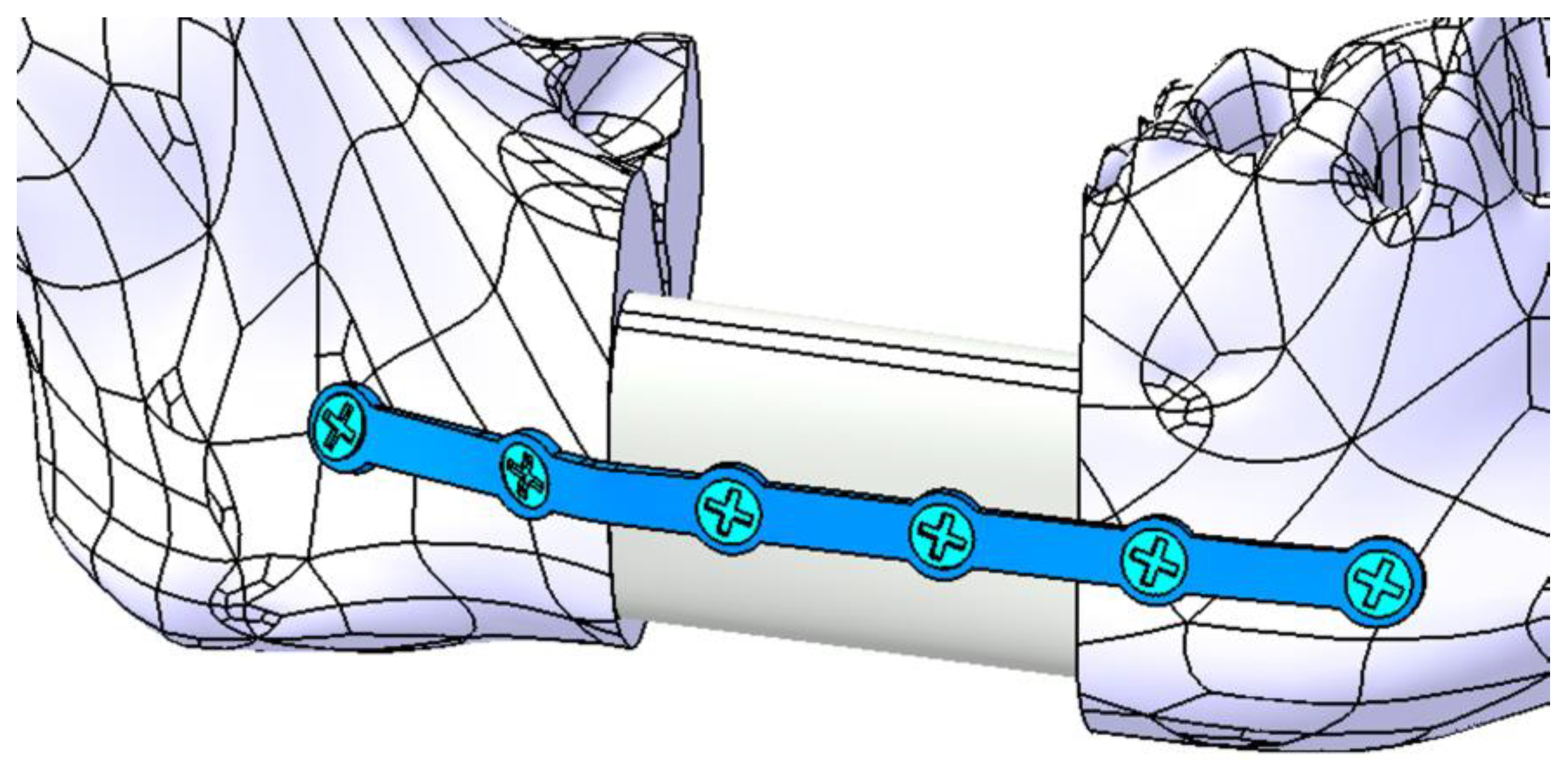 Materials 18 00314 g016