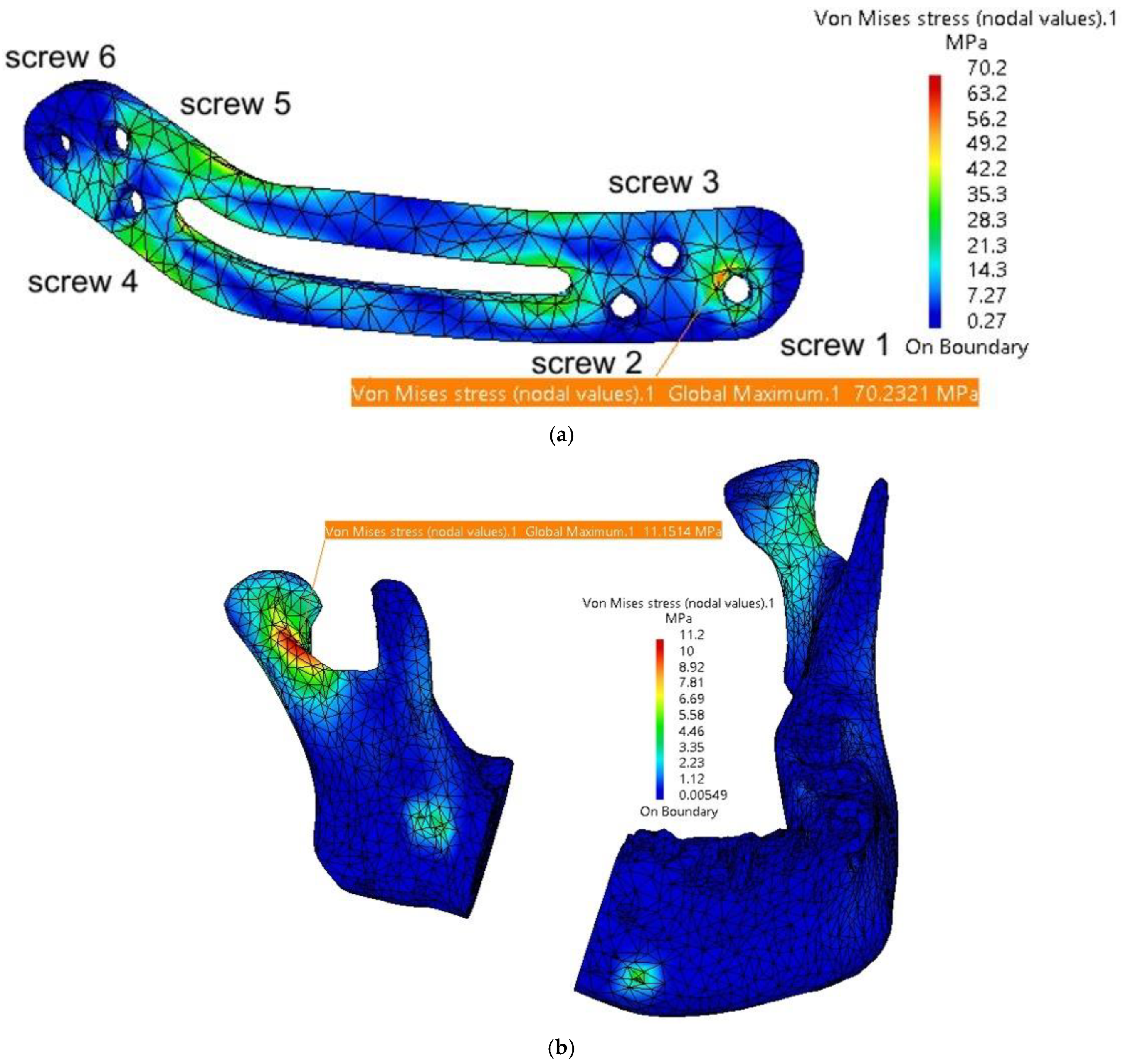 Materials 18 00314 g018