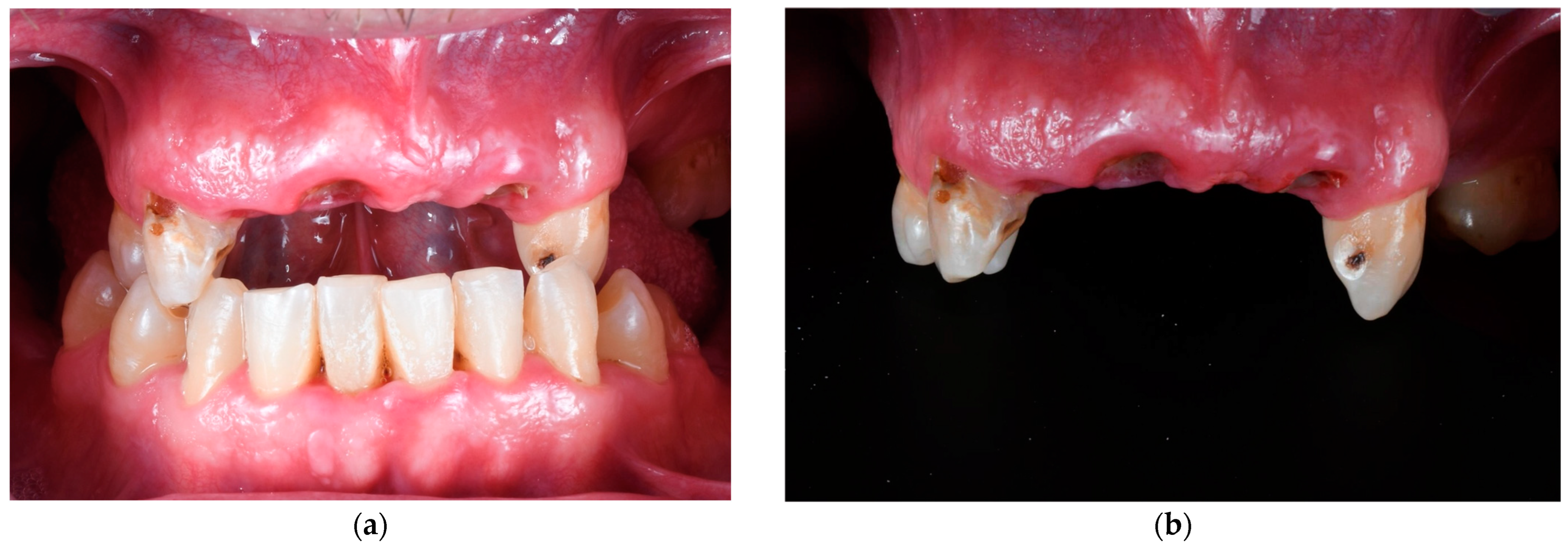 Materials 18 00562 g001