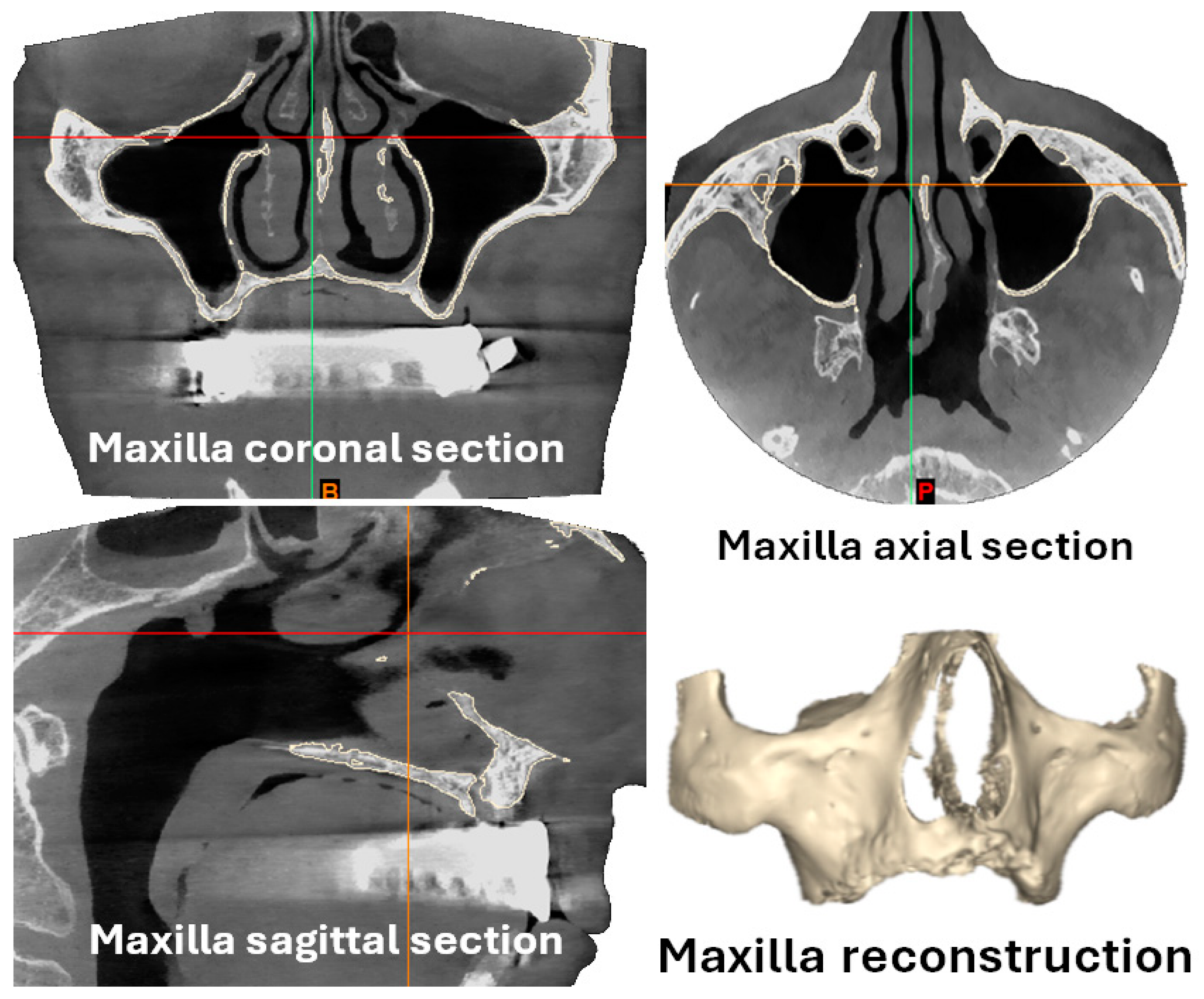 Materials 18 00622 g001a