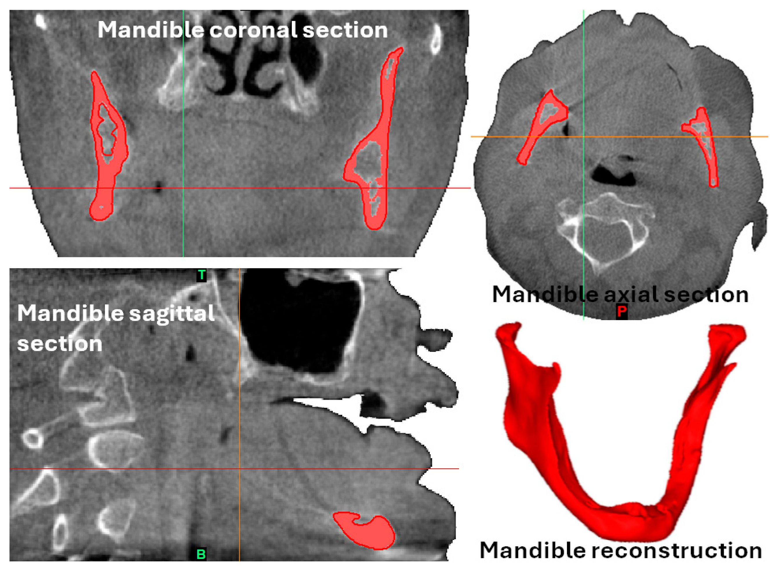 Materials 18 00622 g001b