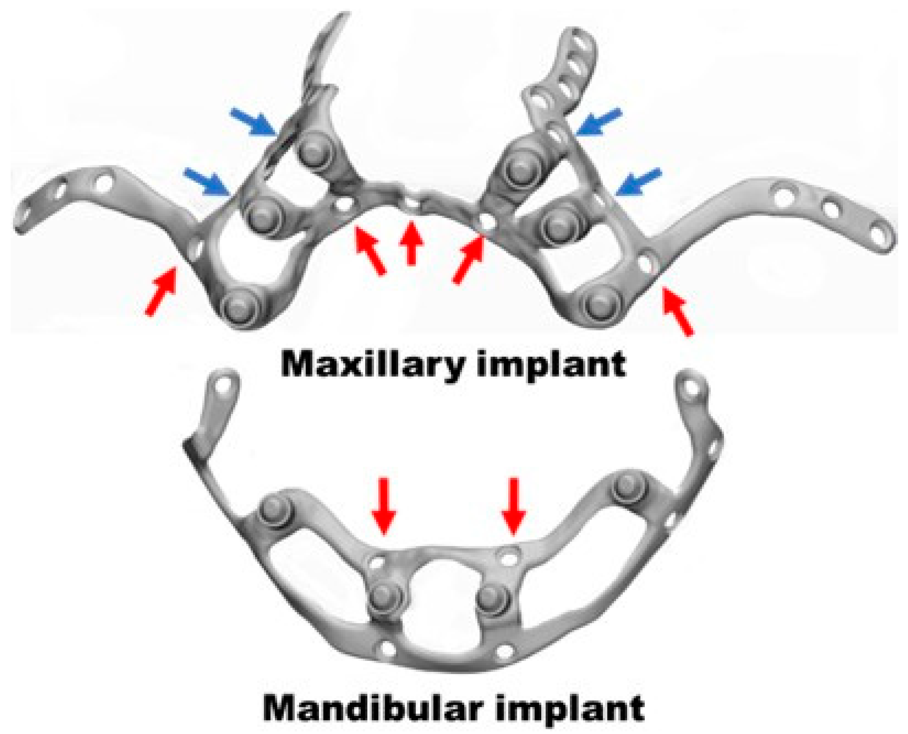 Materials 18 00622 g006