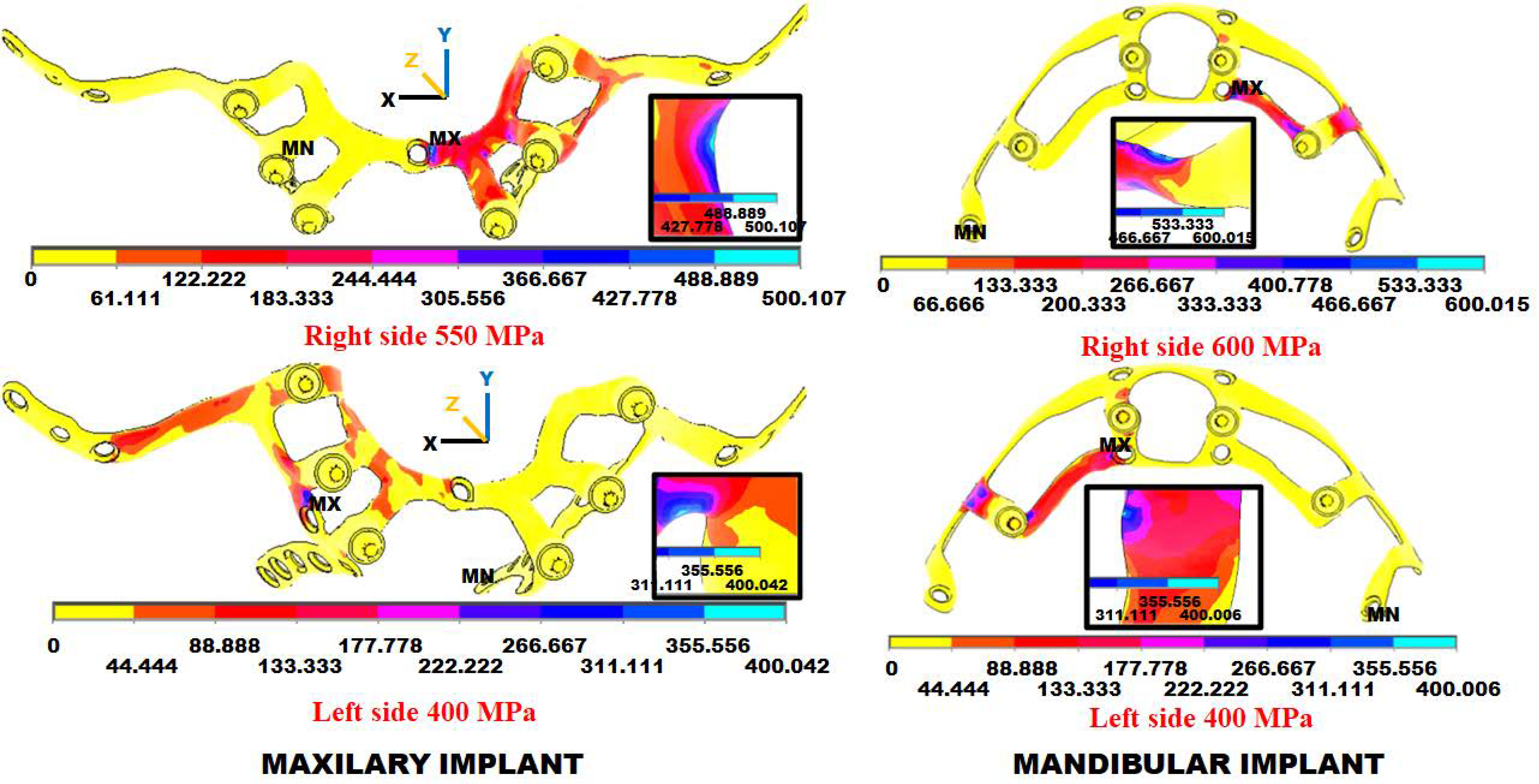 Materials 18 00622 g011