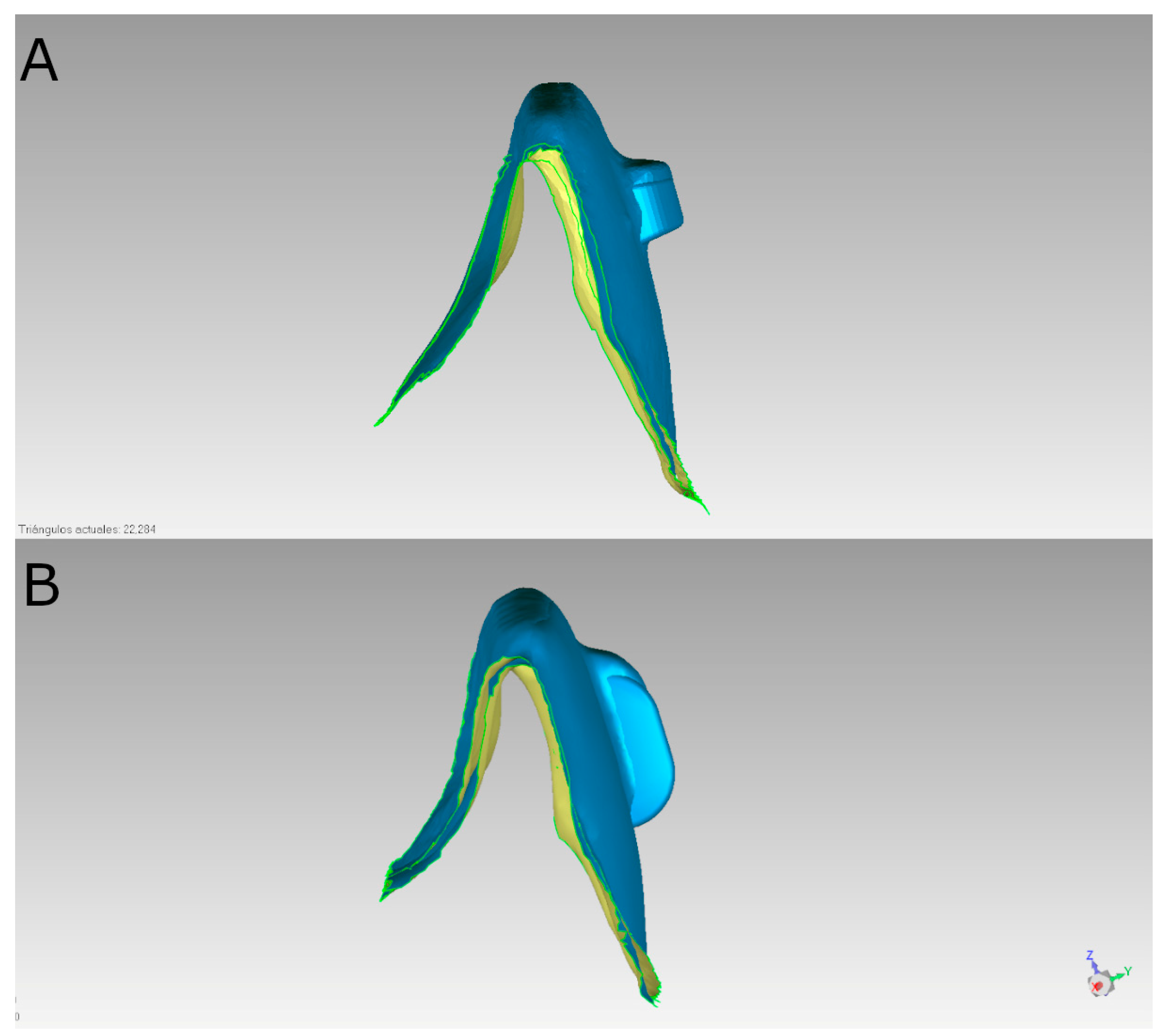 Materials 18 00780 g002