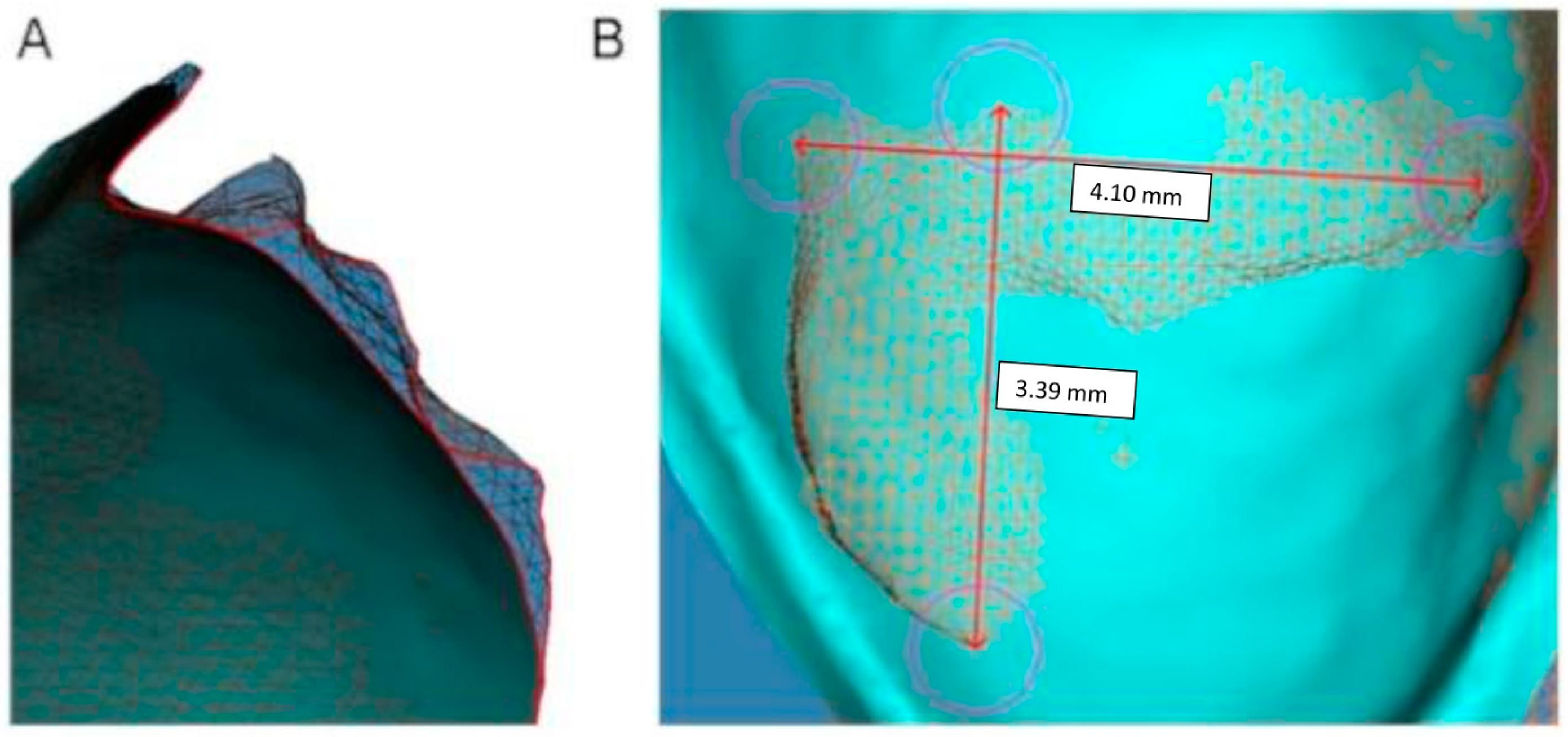 Materials 18 00781 g002