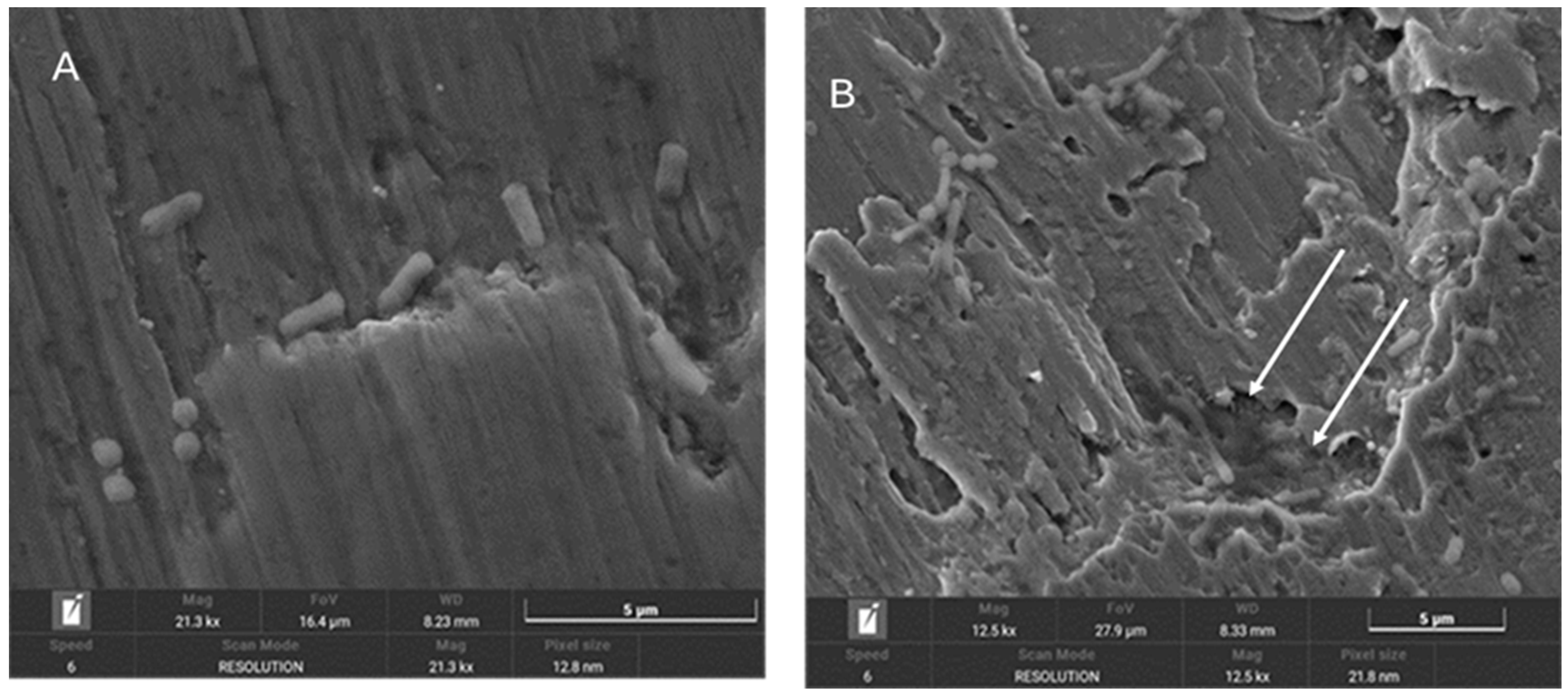 Materials 18 01136 g005