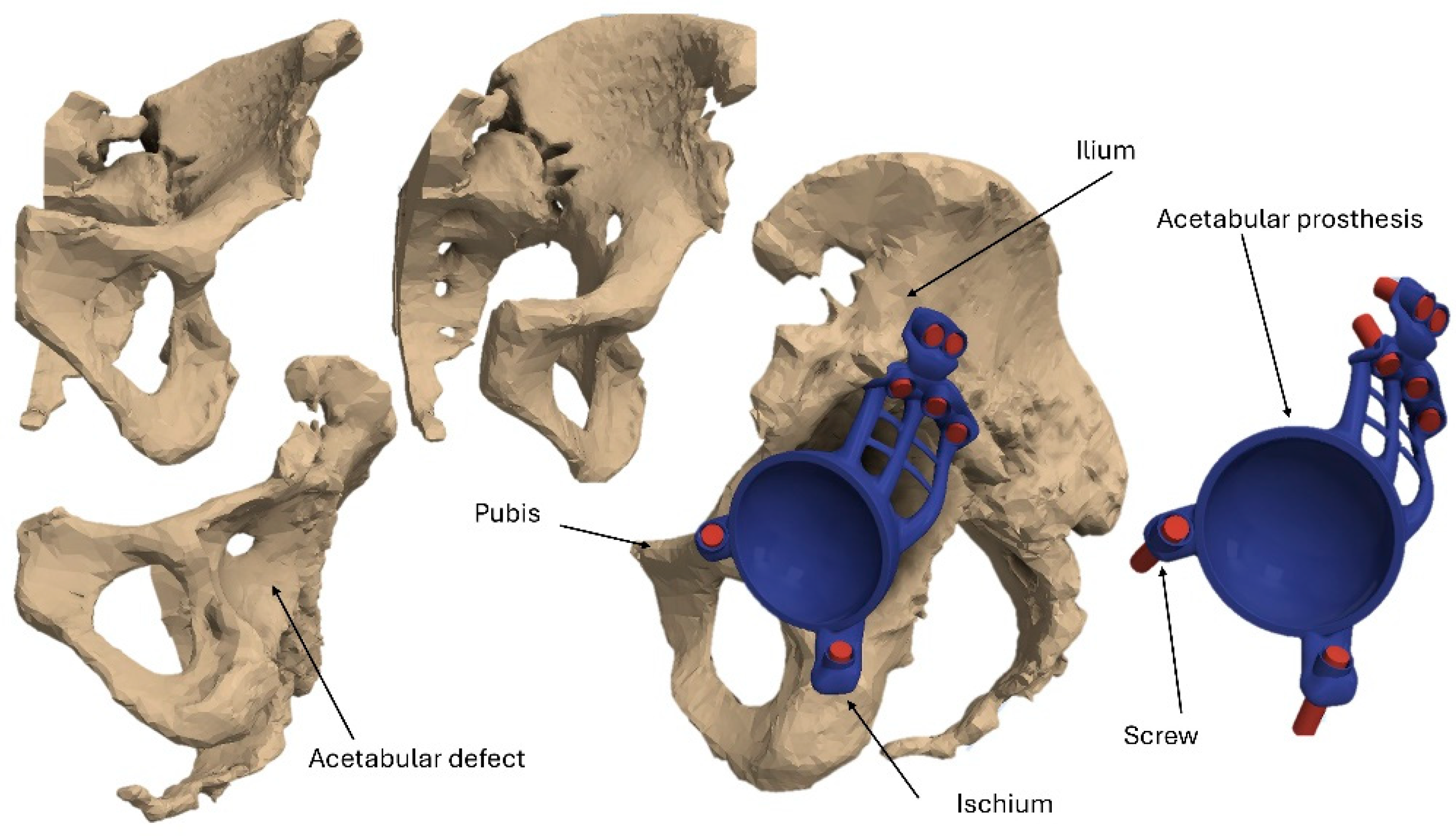 Materials 18 01295 g001