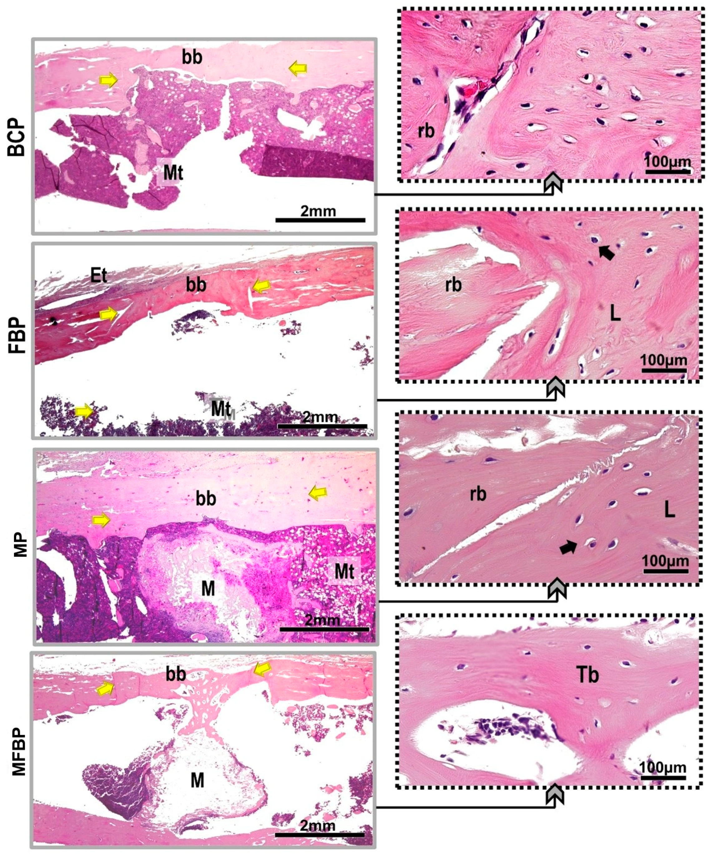 Materials 18 01704 g007