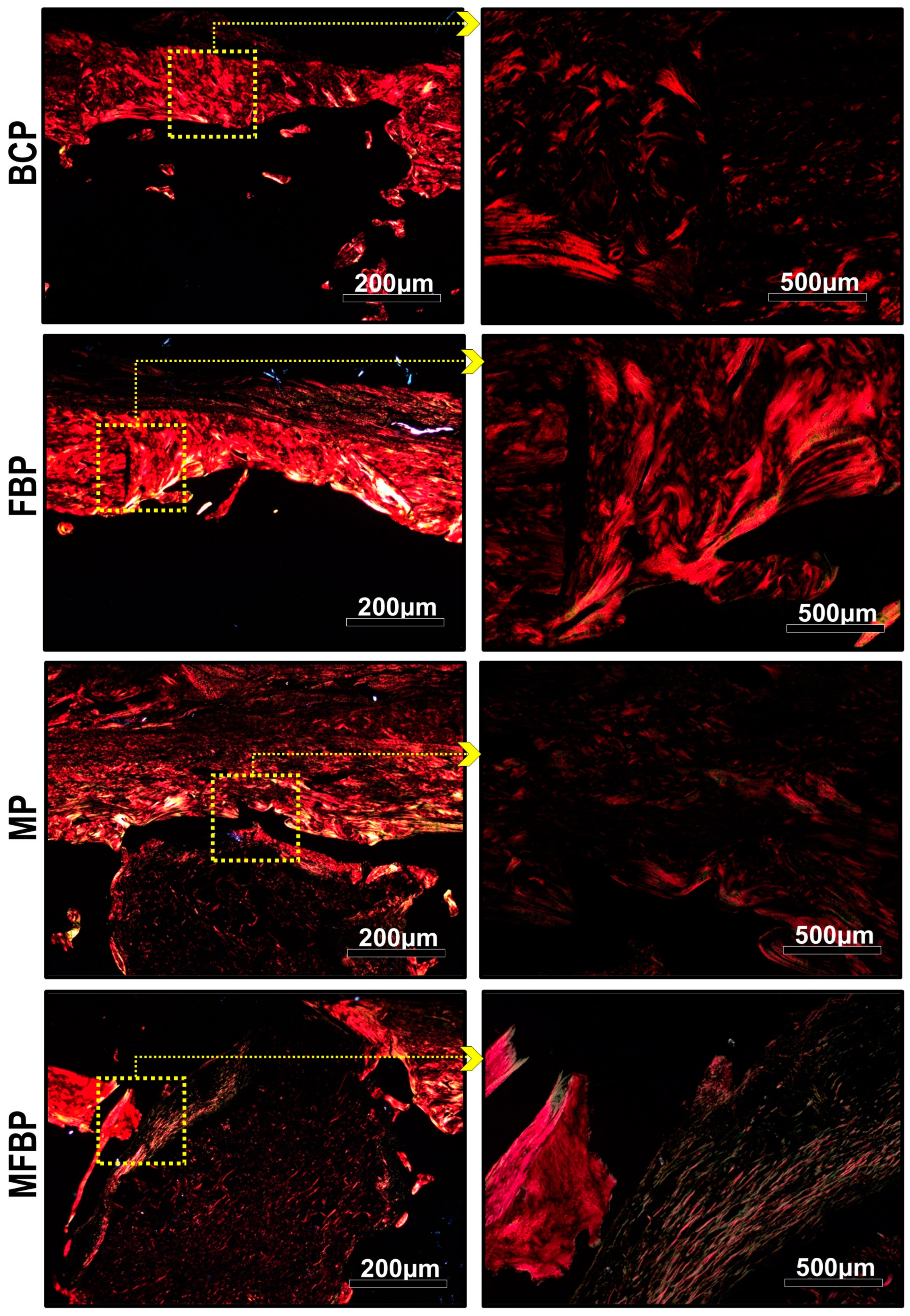 Materials 18 01704 g010