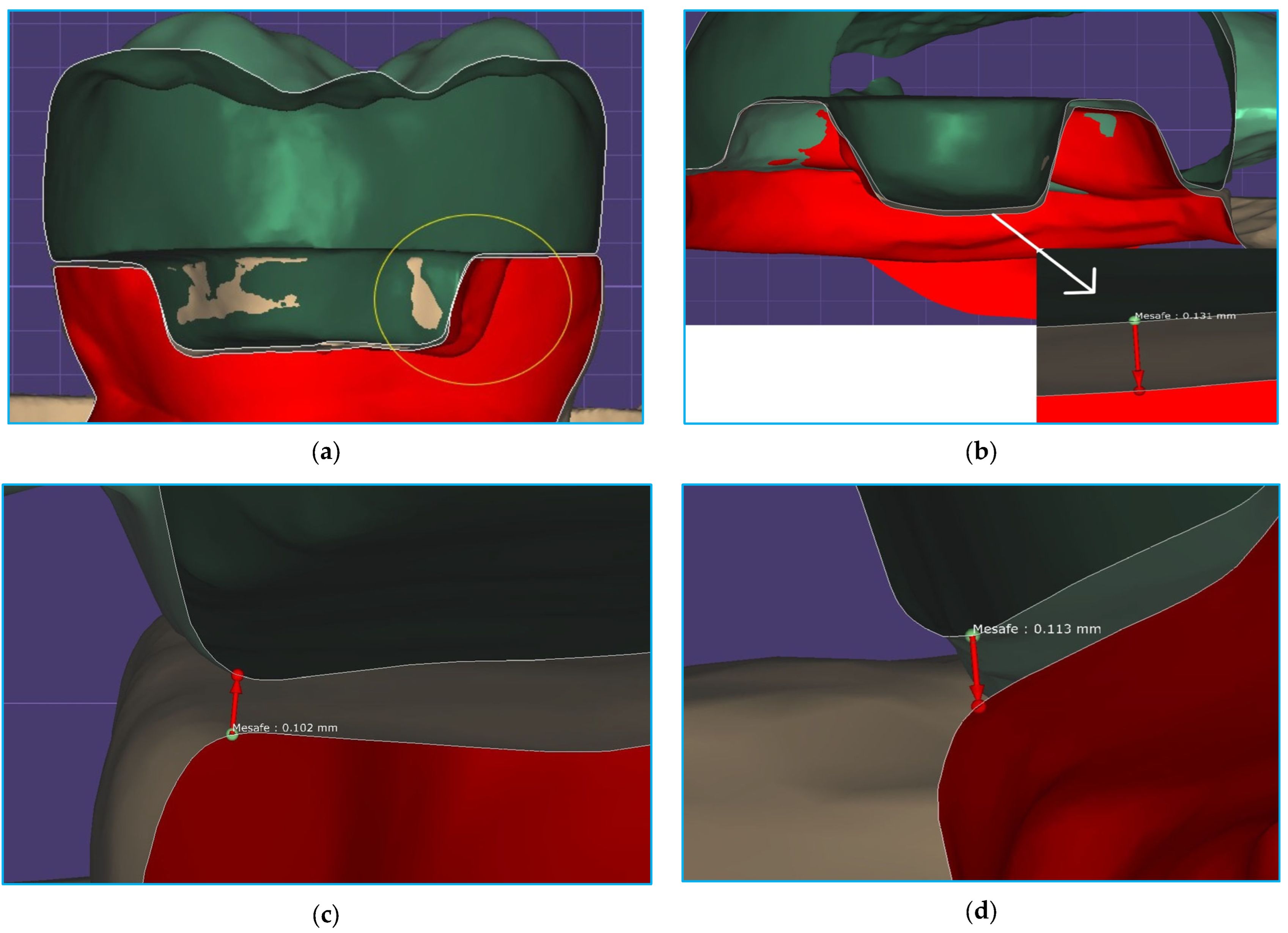 Materials 18 02137 g004