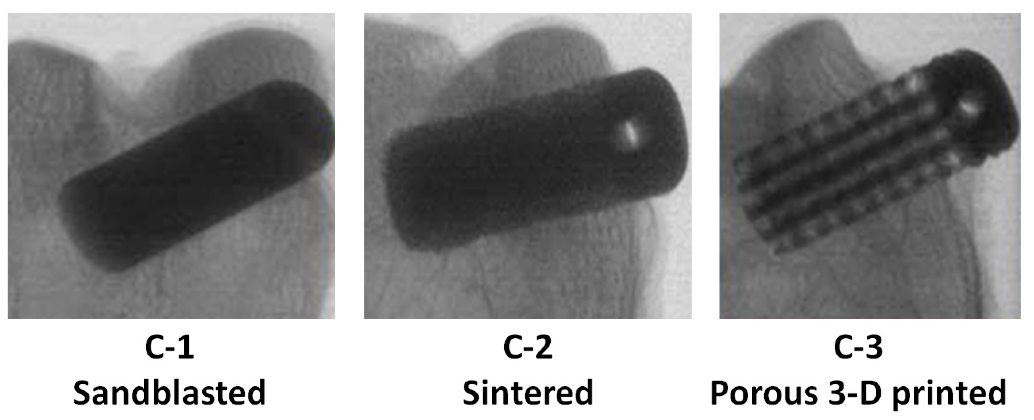 Materials 18 02141 g004