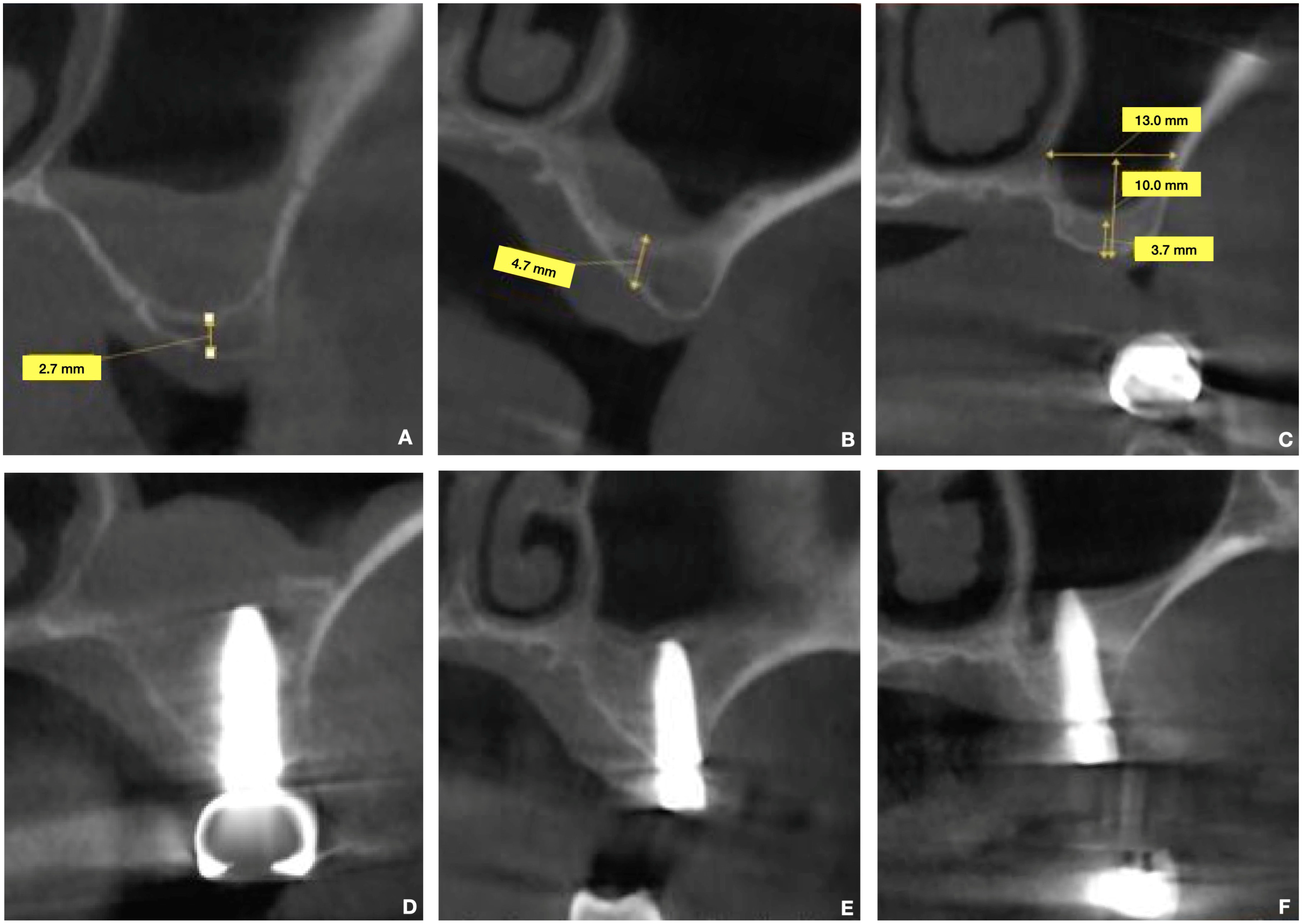 Materials 18 02230 g003