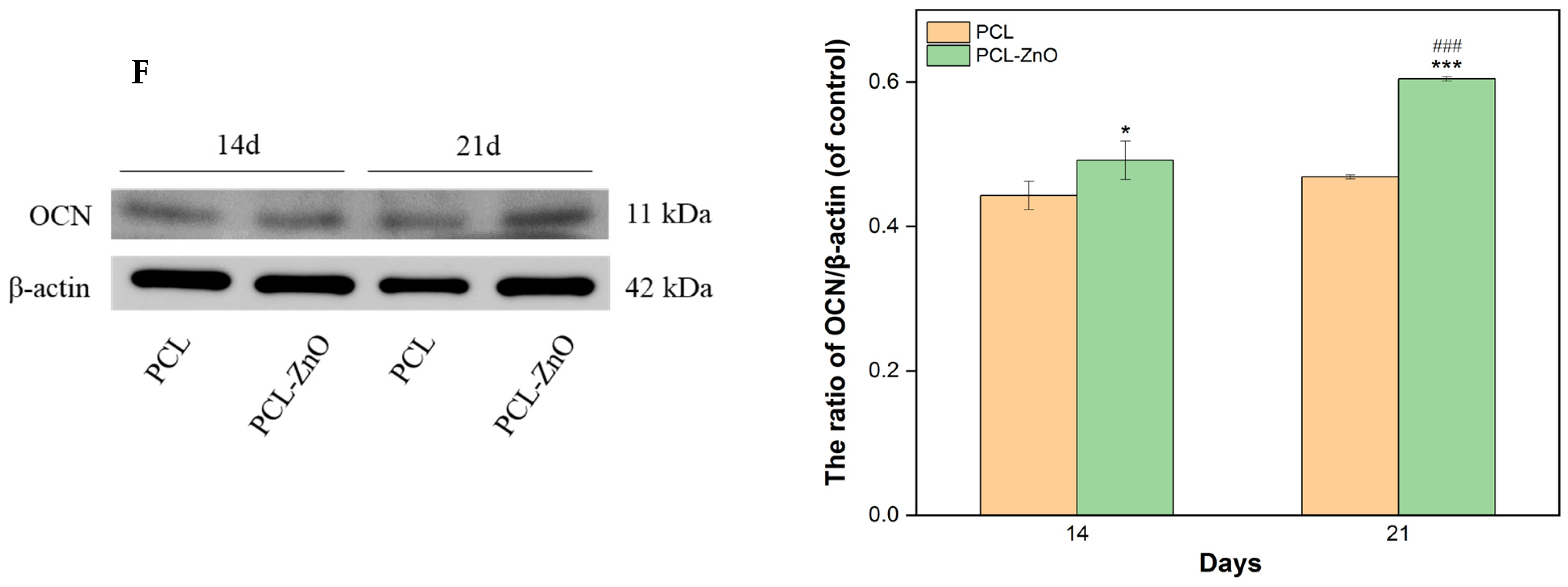 Materials 18 02295 g005d