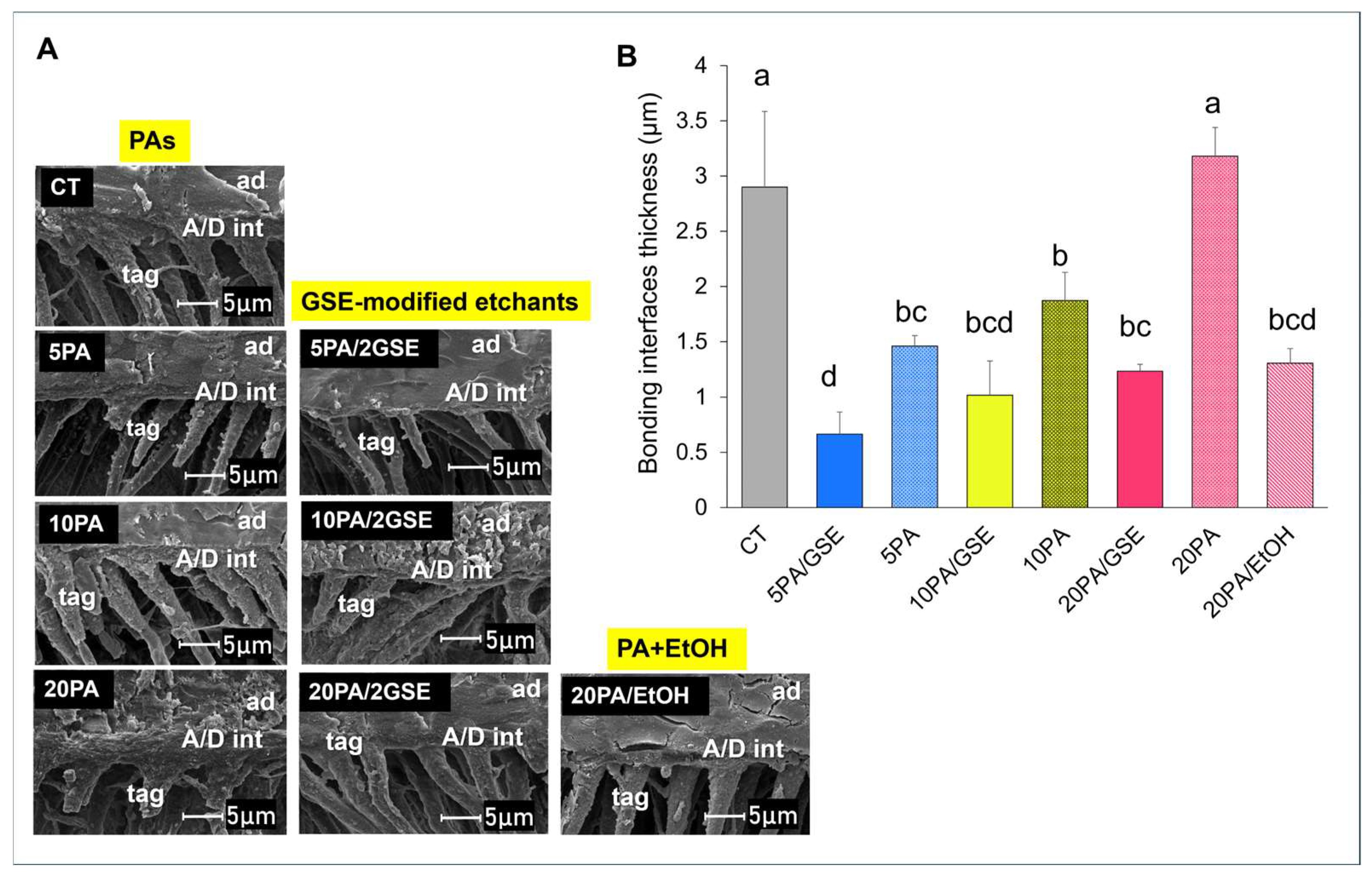 Materials 18 02416 g004