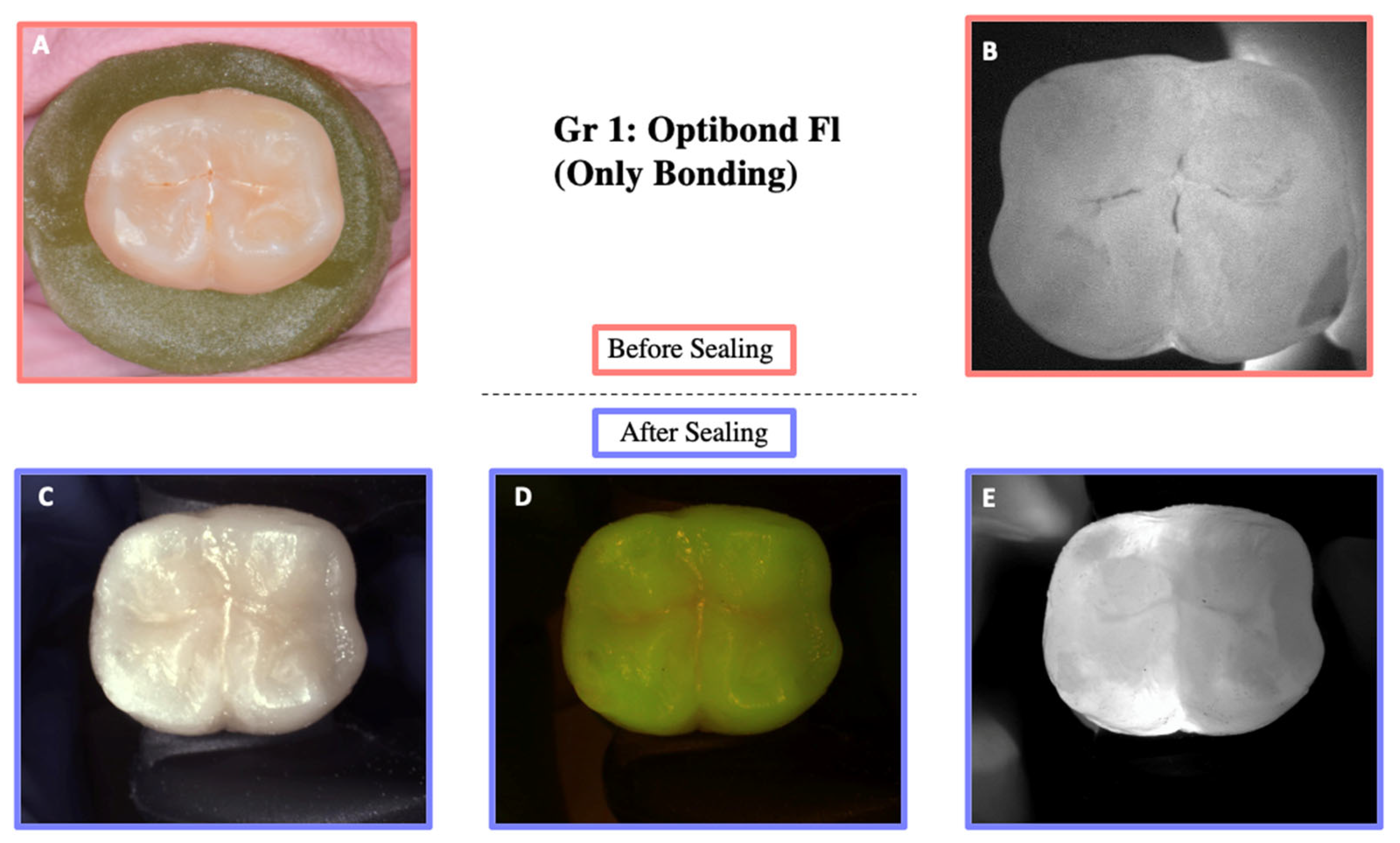 Materials 18 02421 g005