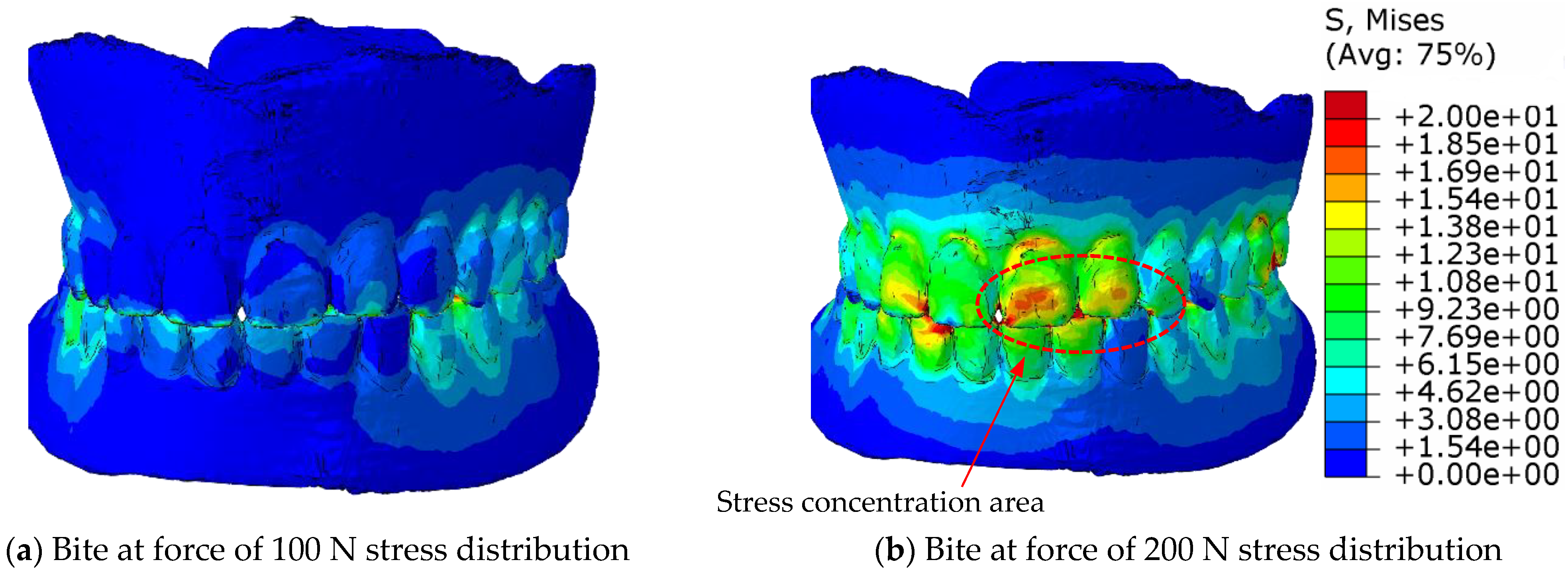 Materials 18 02427 g011