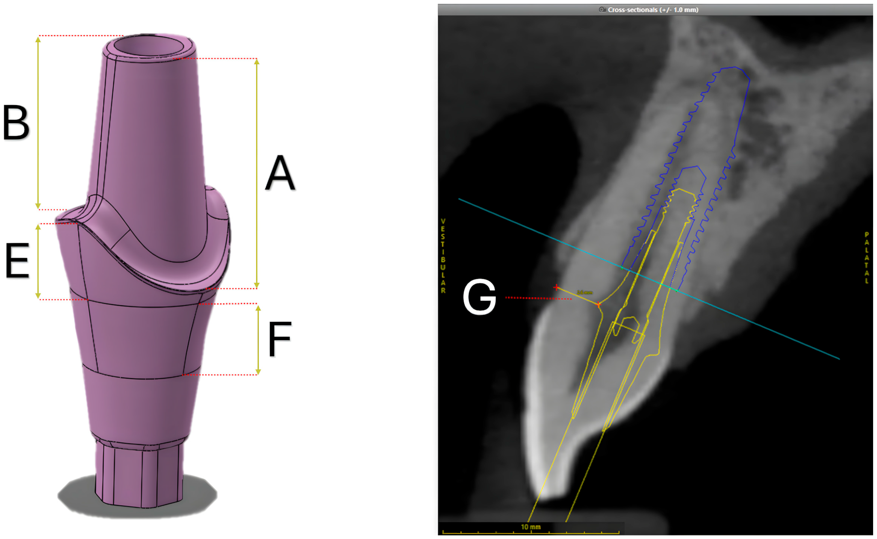 Materials 18 03420 g002