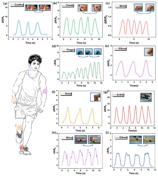 Deep Neural-Assisted Flexible MXene-Ag Composite Strain