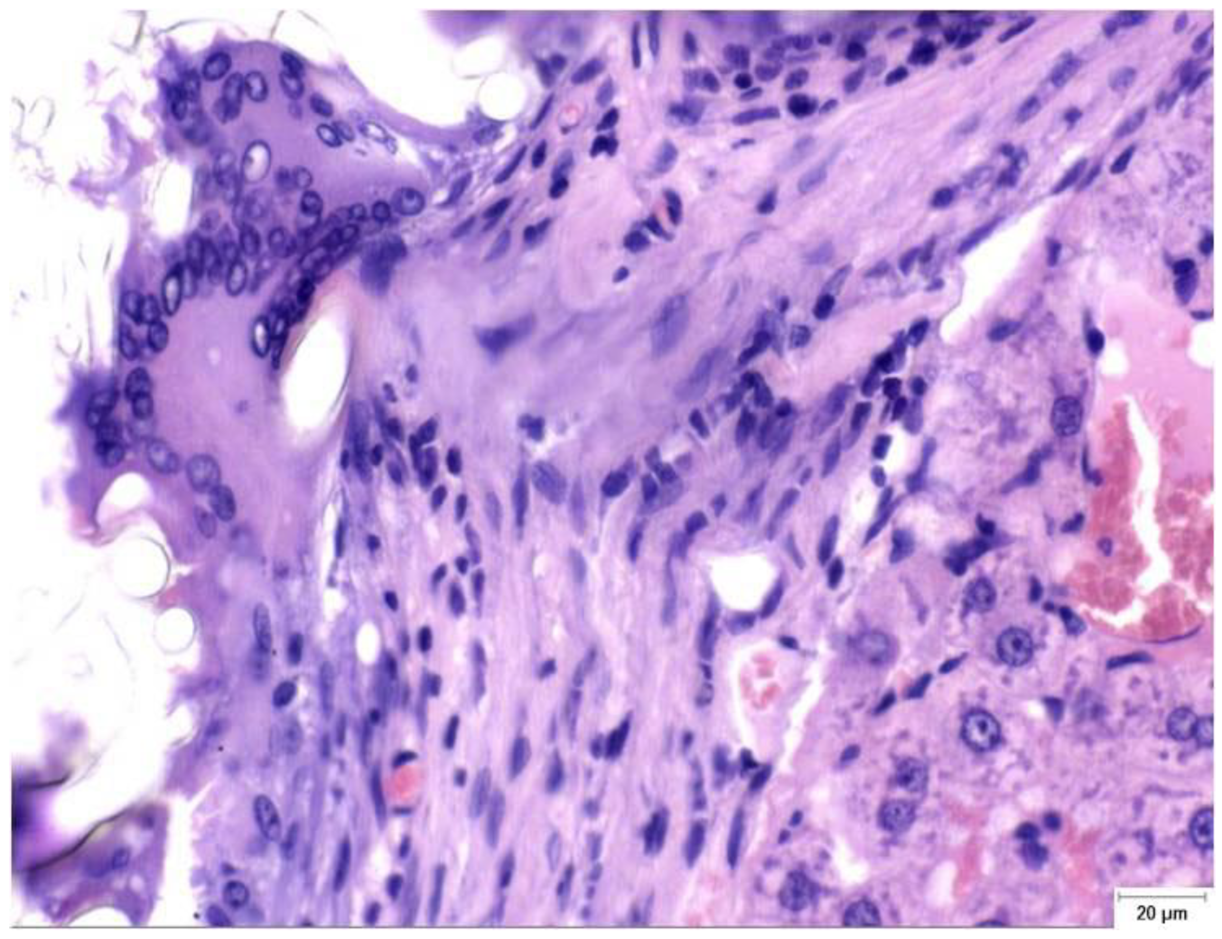 Materials 18 03581 g002