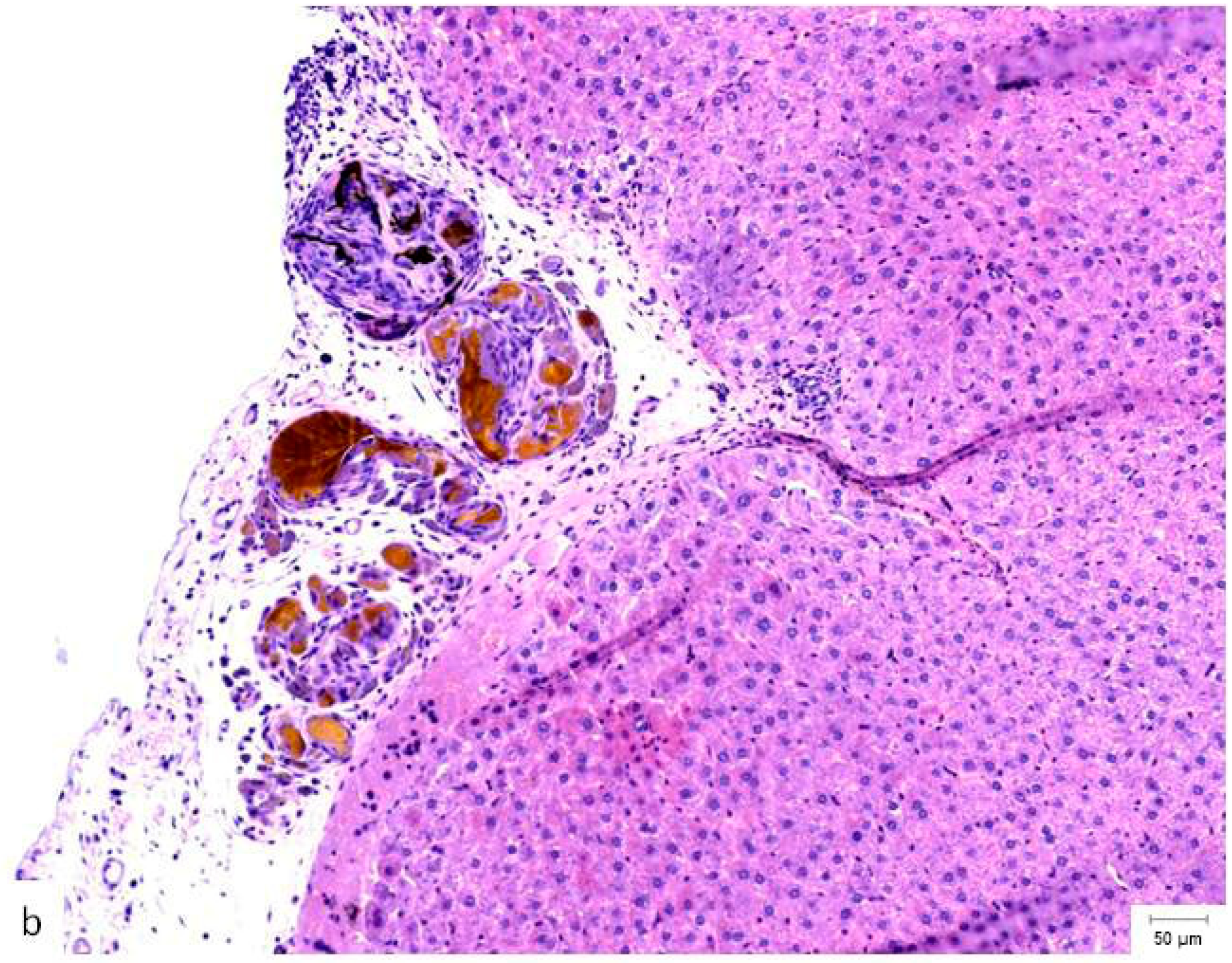 Materials 18 03581 g004b