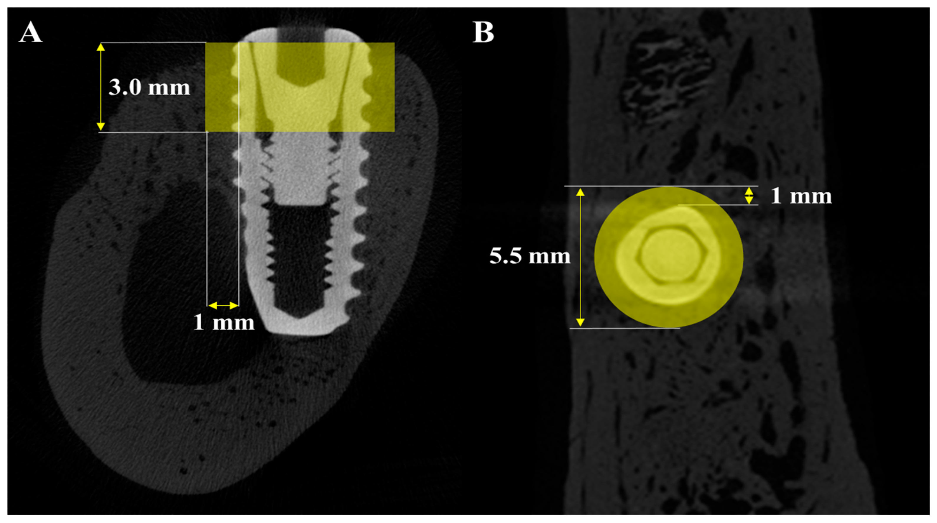 Materials 18 03582 g003 Materials 18 03582 g003