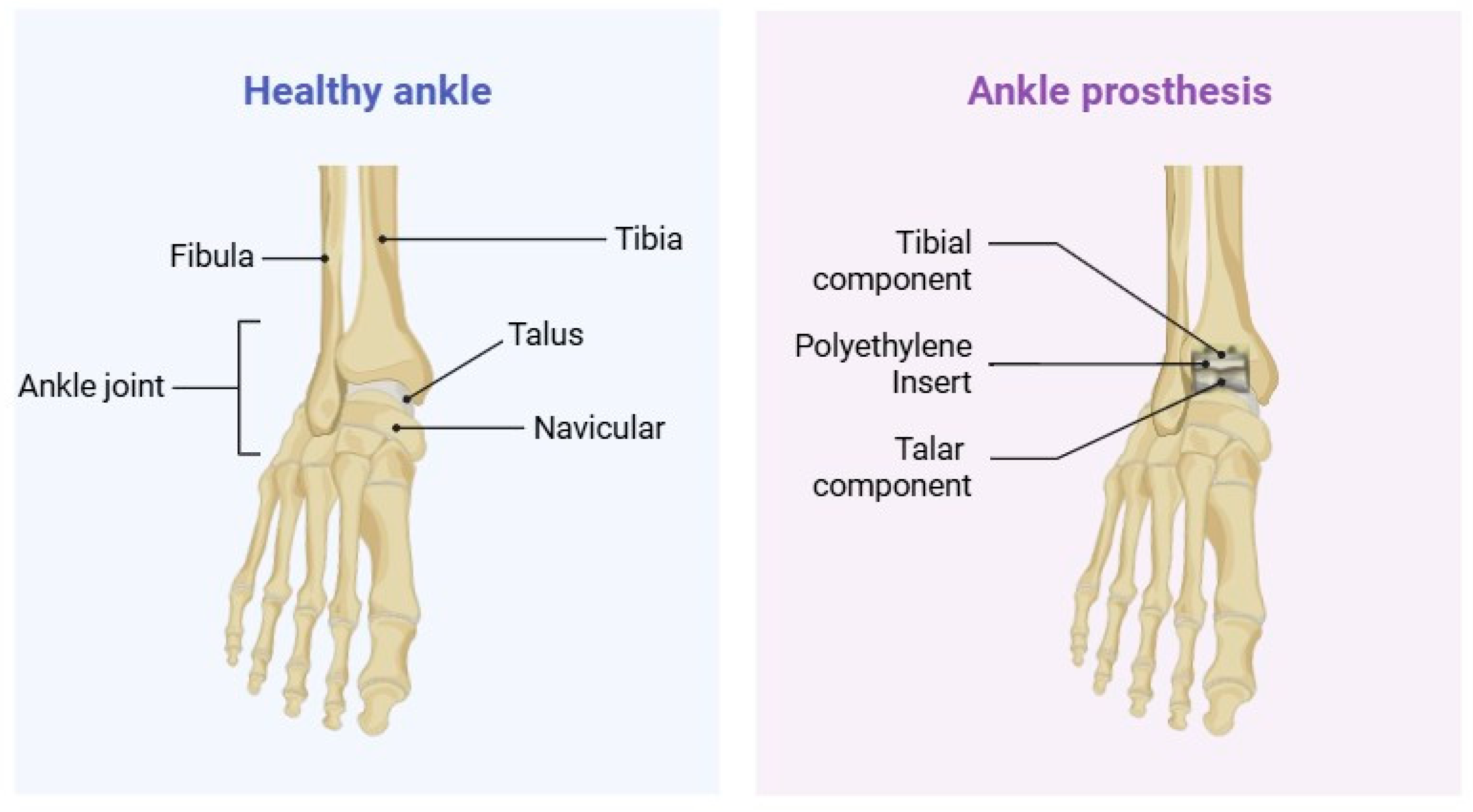 Materials 18 03770 g001 Materials 18 03770 g001