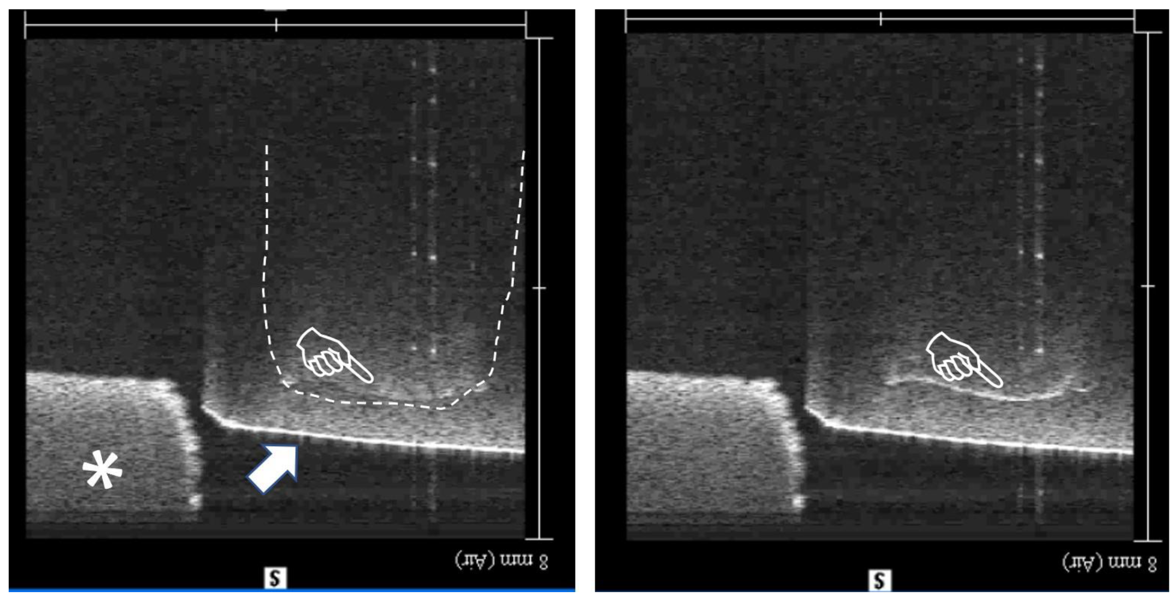 Materials 18 03790 g002