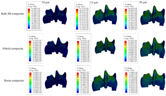 Investigation of Stress Distribution and Fatigue Performance in ...