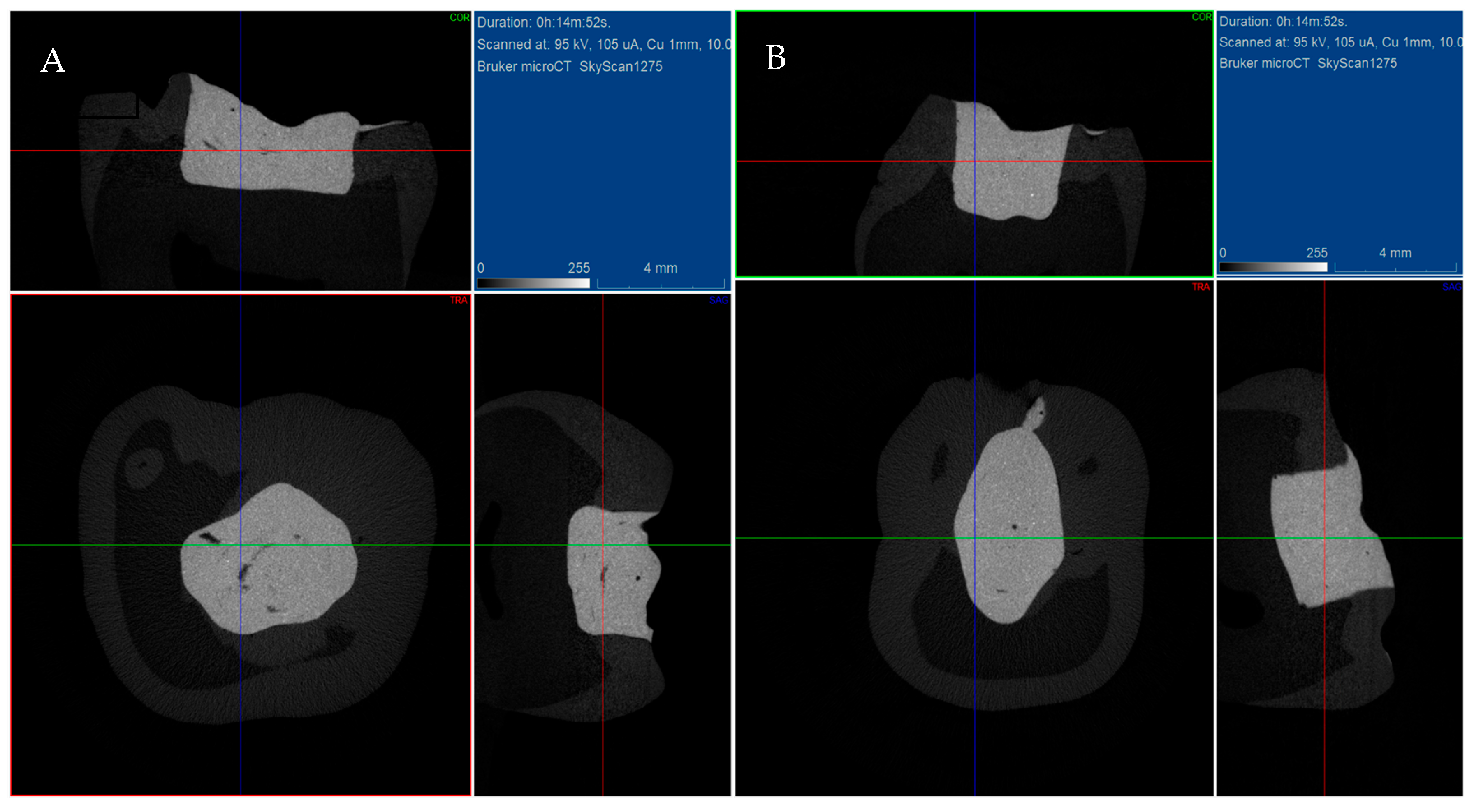 Materials 18 04027 g001