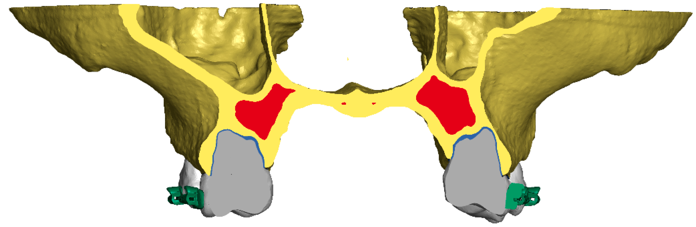 Materials 18 05290 g003
