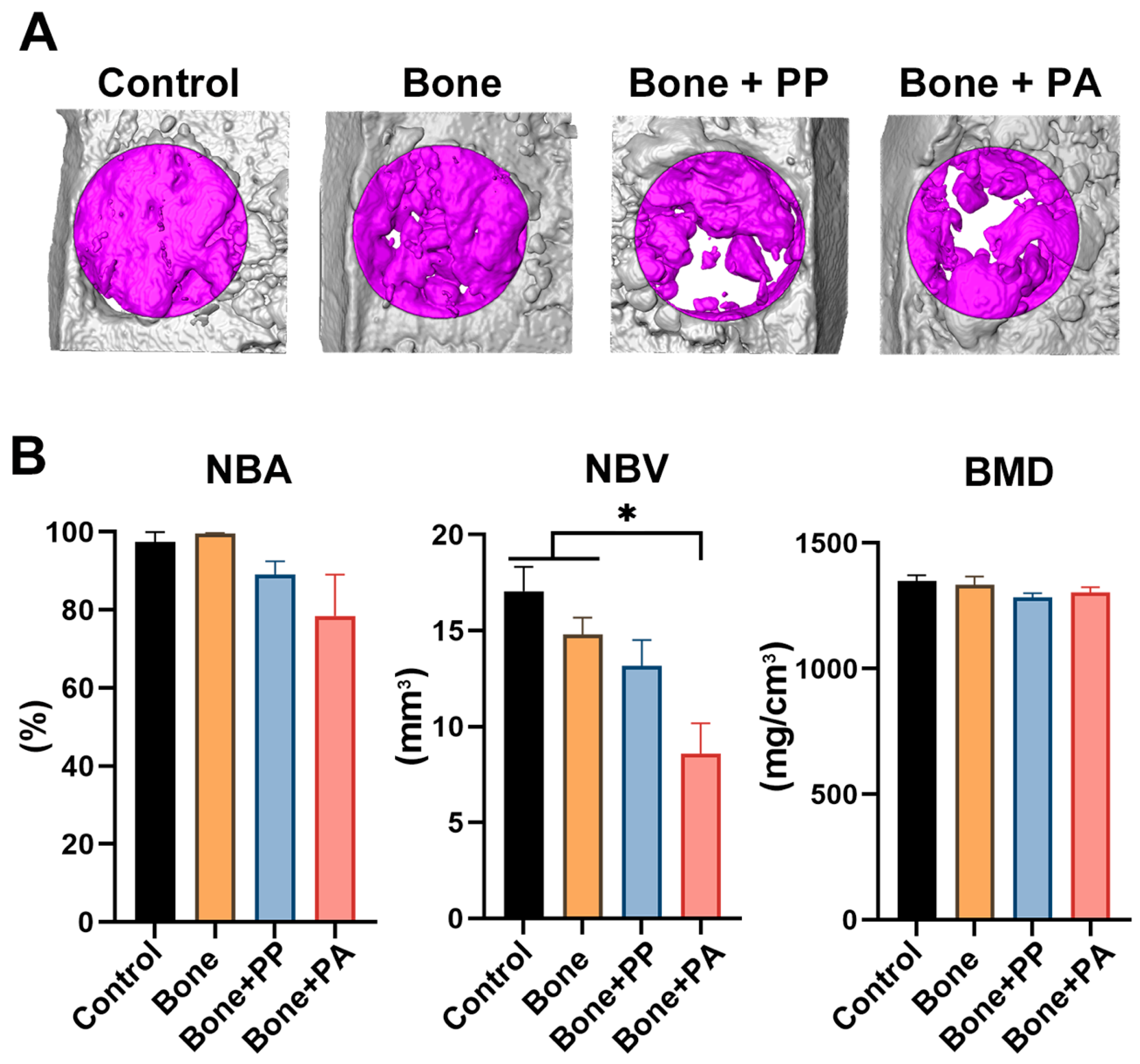 Materials 18 05624 g005