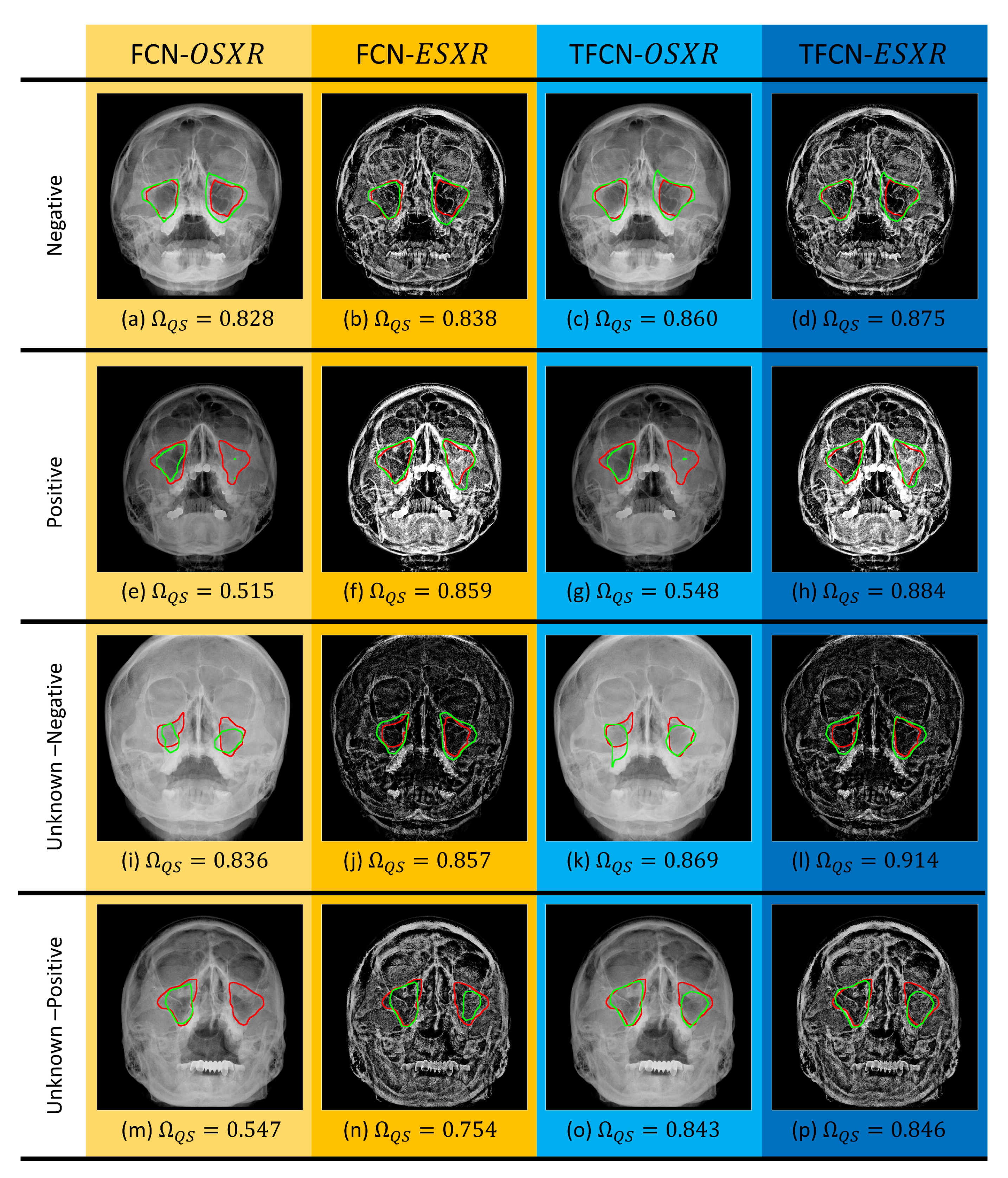 Mathematics 08 00768 g004